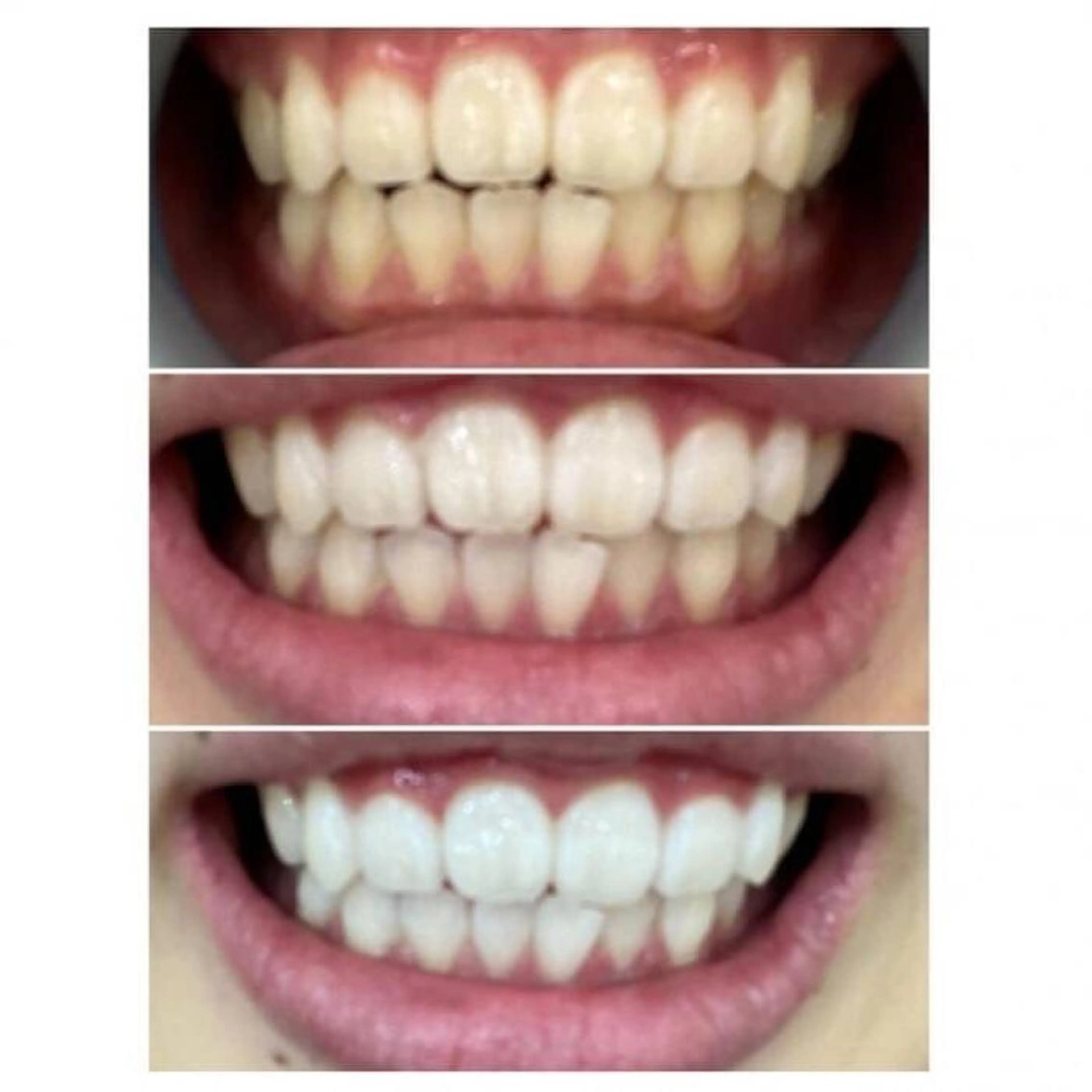 Ｍ渋谷 ホワイトニングのエステ・リラクイメージ