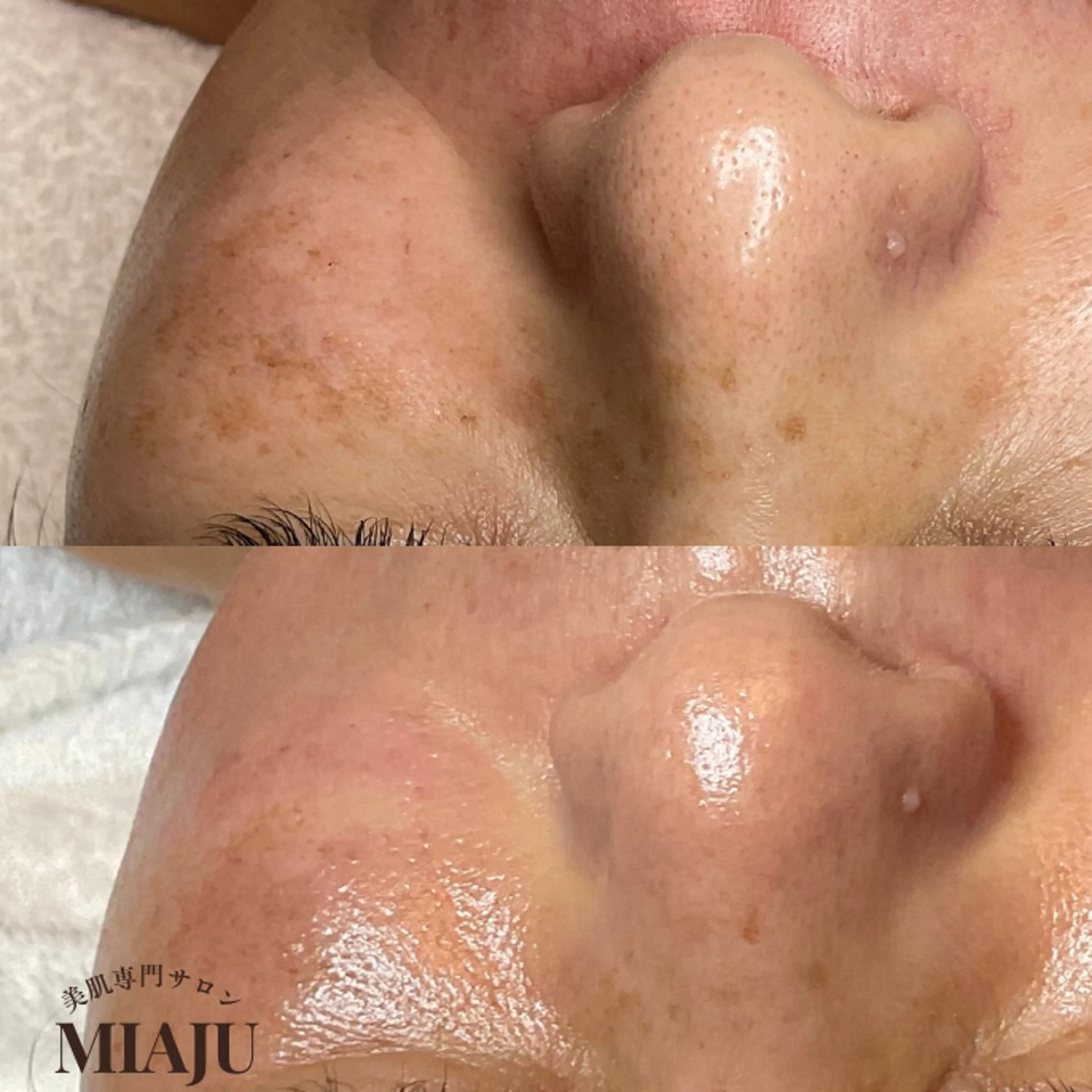 エステ 美肌専門サロン MIAJUのエステ・リラクイメージ