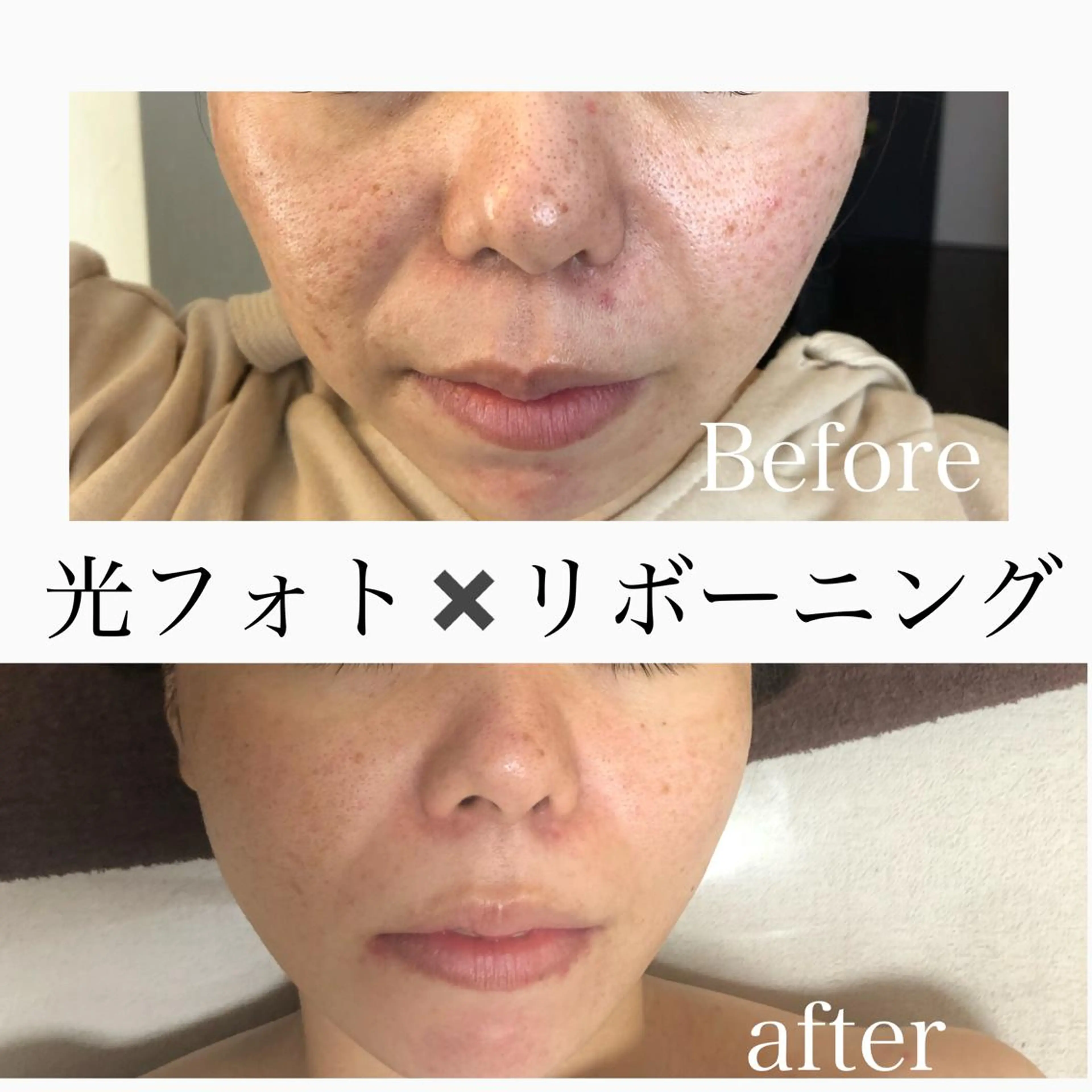 gratia ~ｸﾞﾚｲﾃｨｱ~のエステ・リラクイメージ