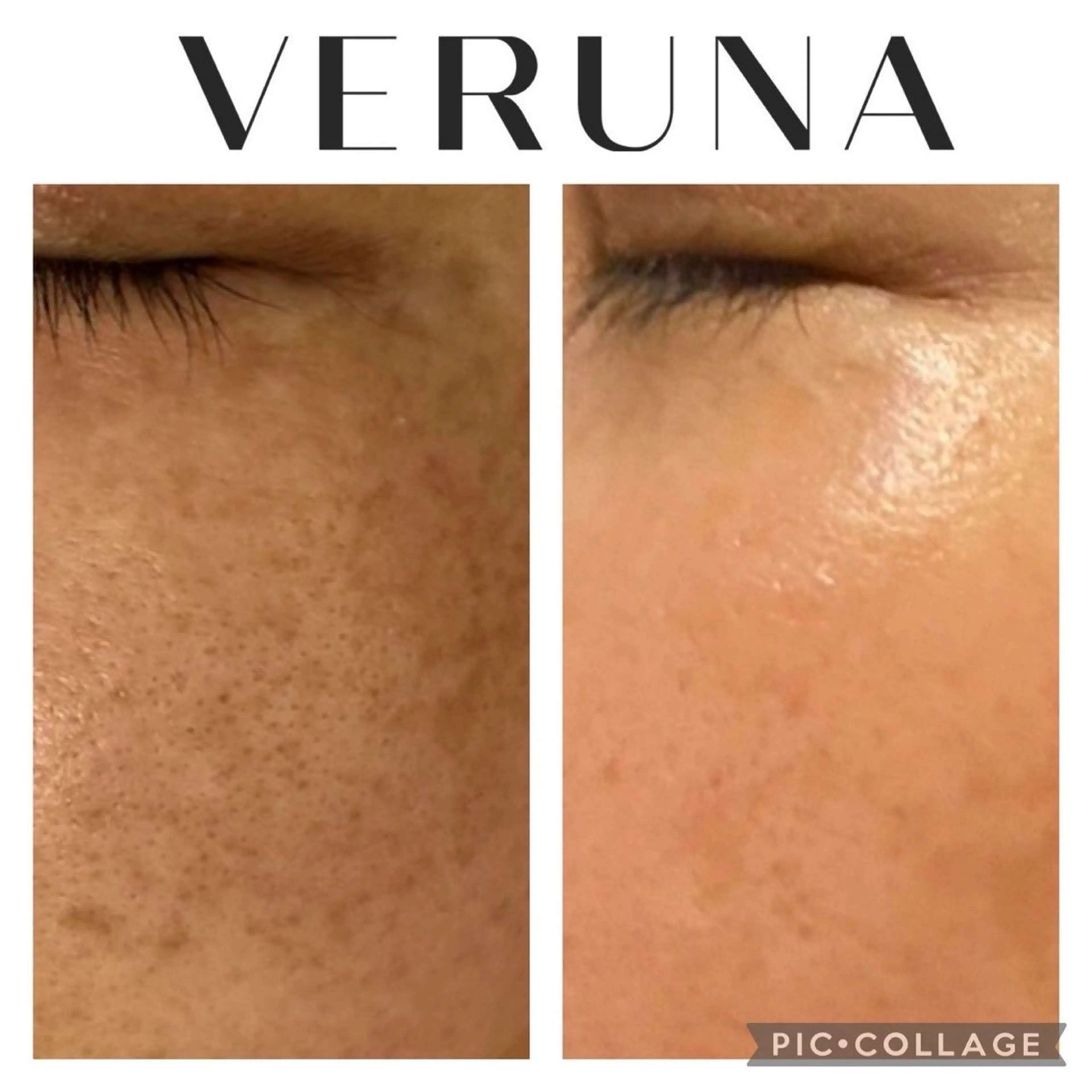 エステ 毛穴改善サロン d'Alba大阪住吉のエステ・リラクイメージ