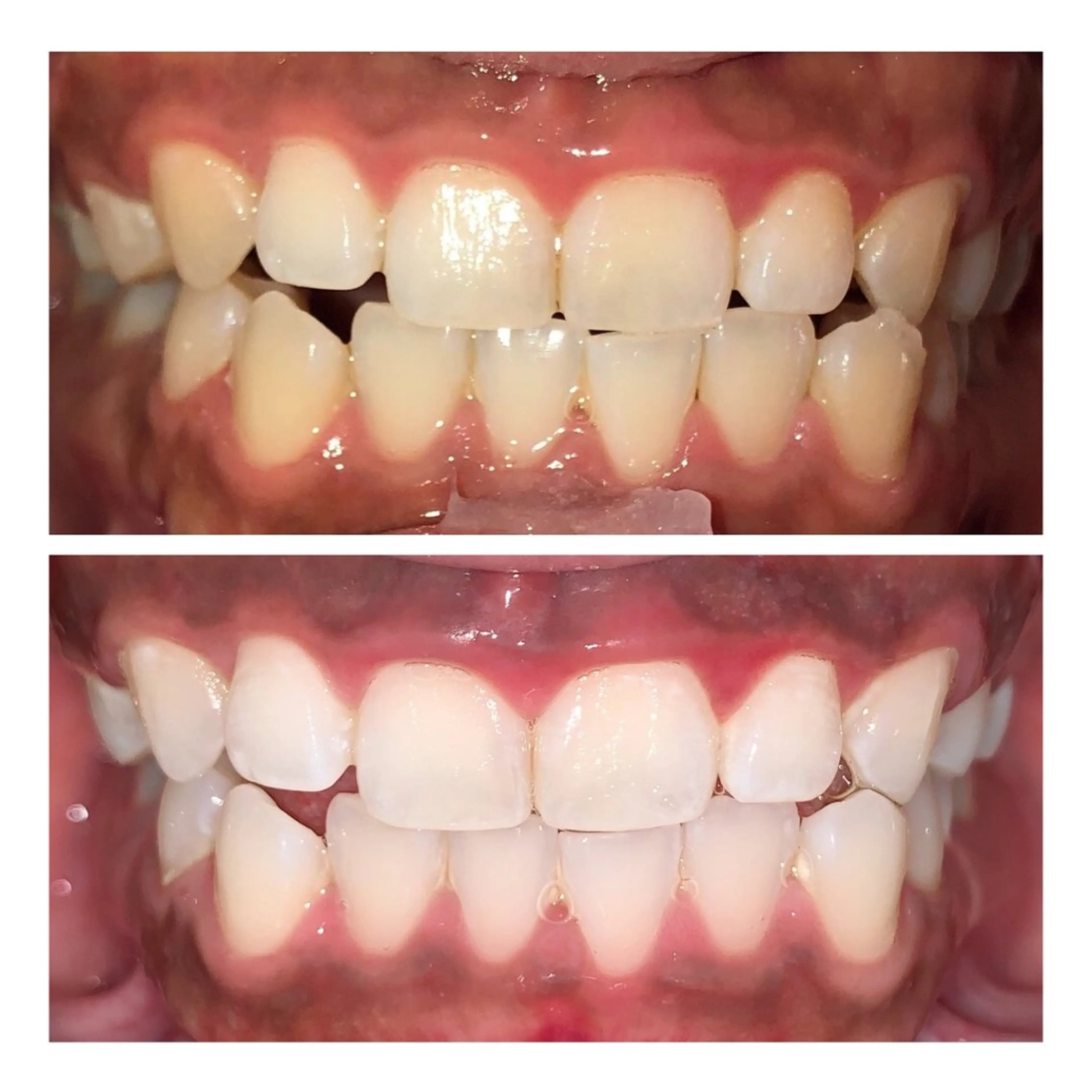 その他 韓国式3D毛穴洗浄 lonhanaのその他イメージ