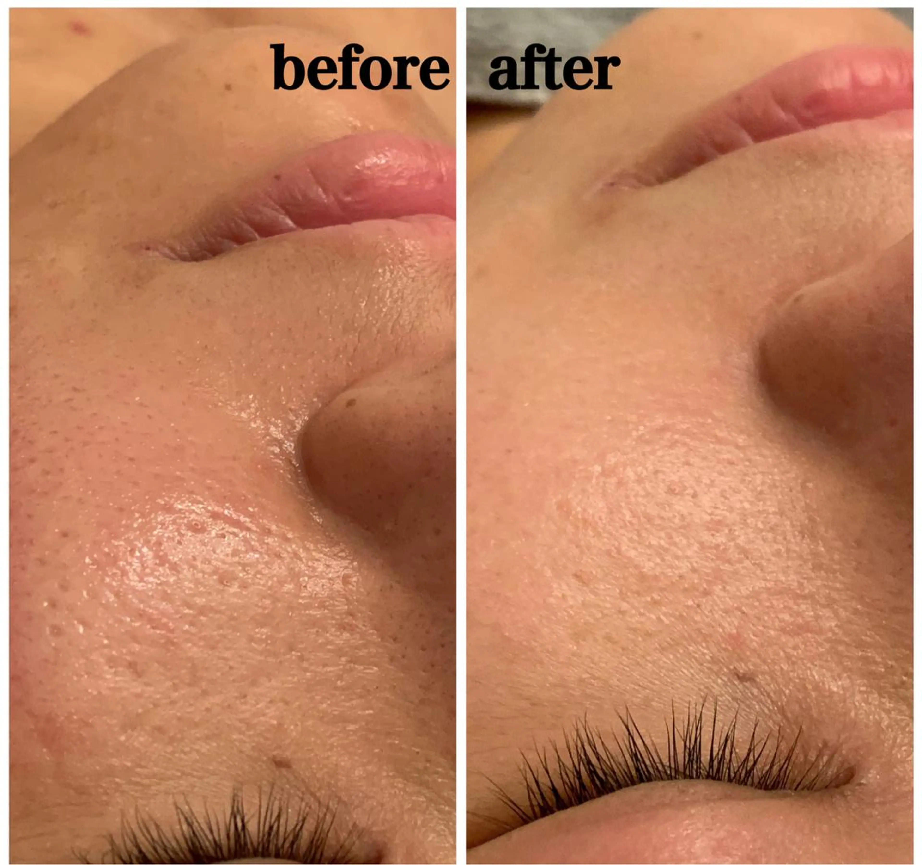 食べながら魅せボディ éclatJua川越のエステ・リラクイメージ