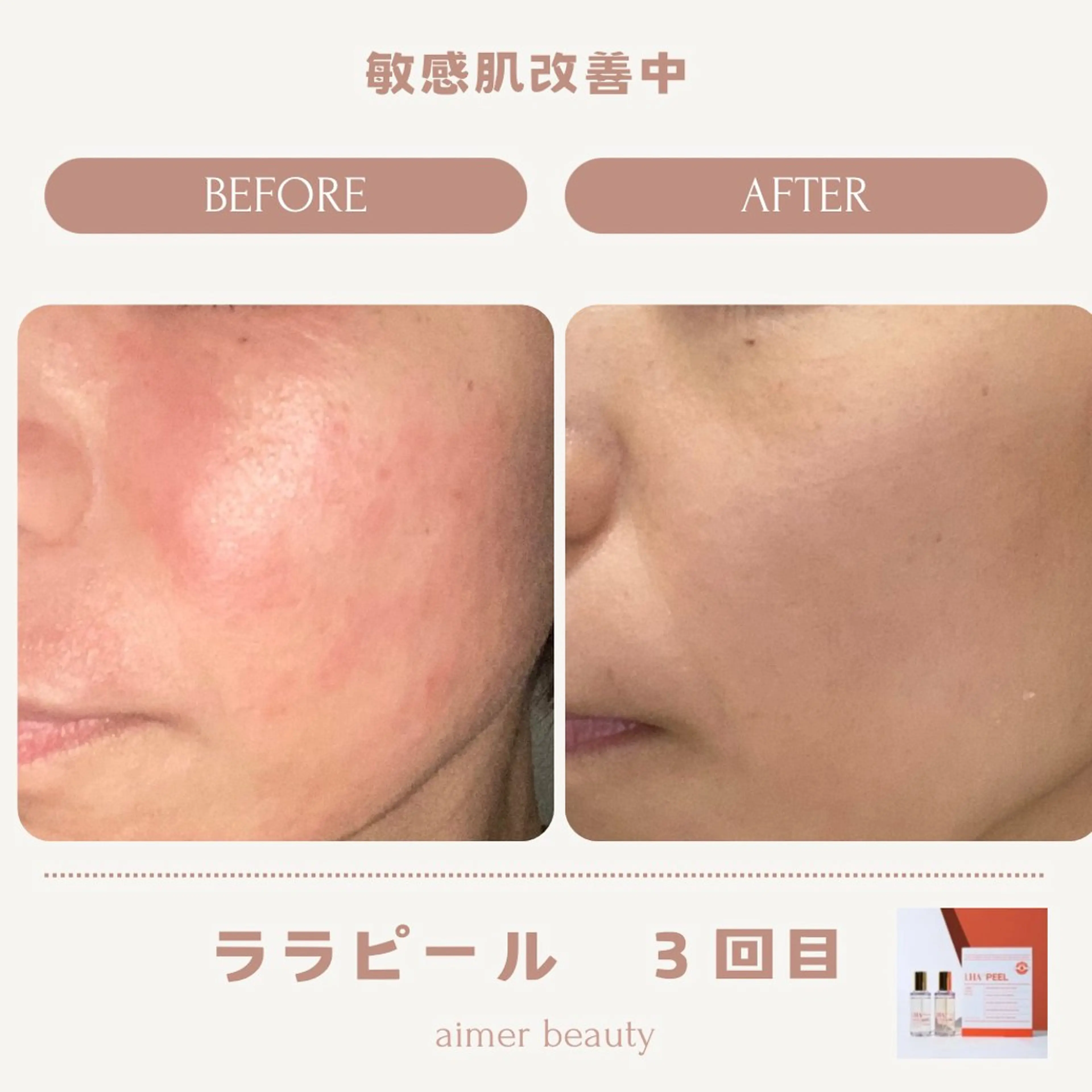 エステ aimer beautyのエステ・リラクイメージ