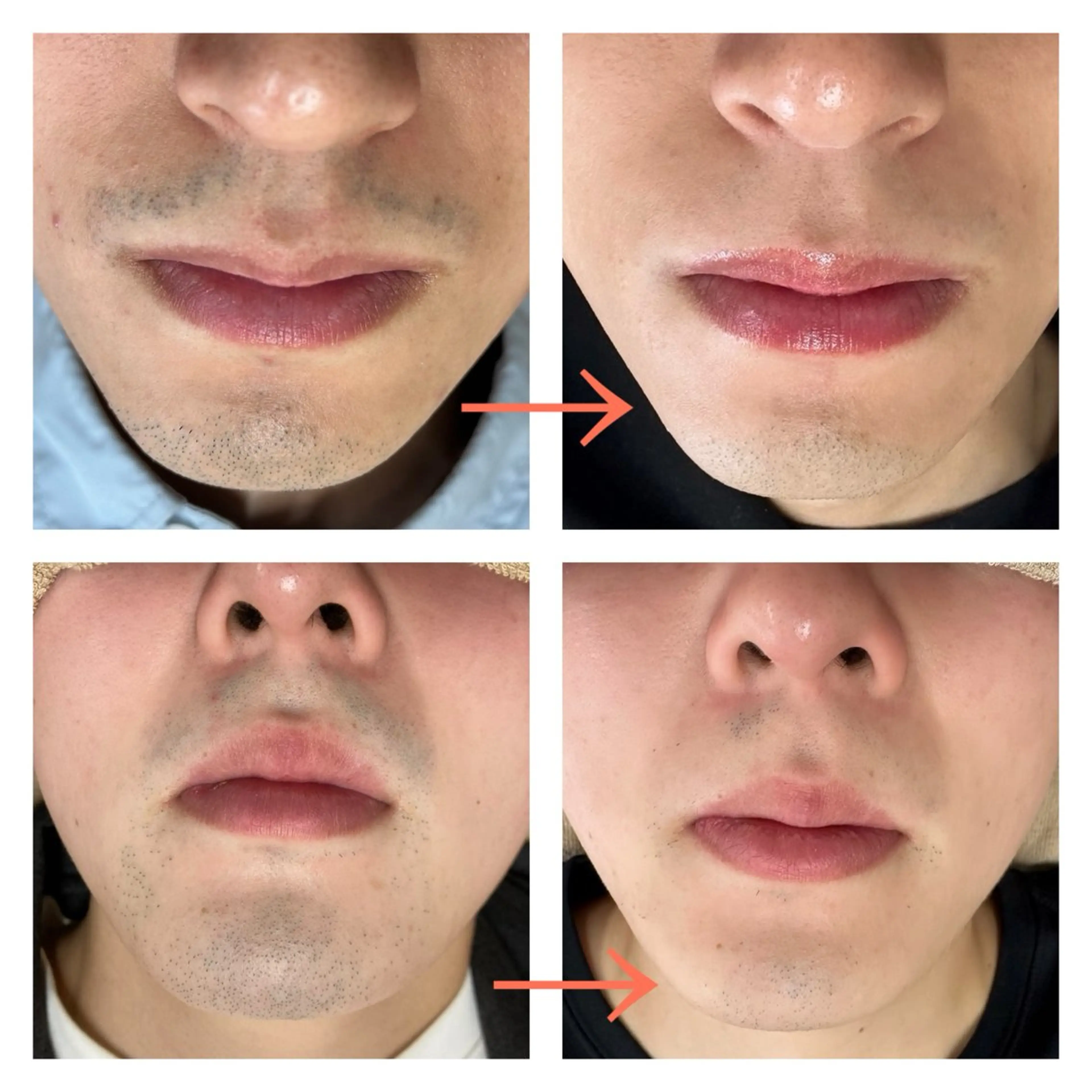 脱毛 サロンドチェリー 《我妻》のエステ・リラクイメージ