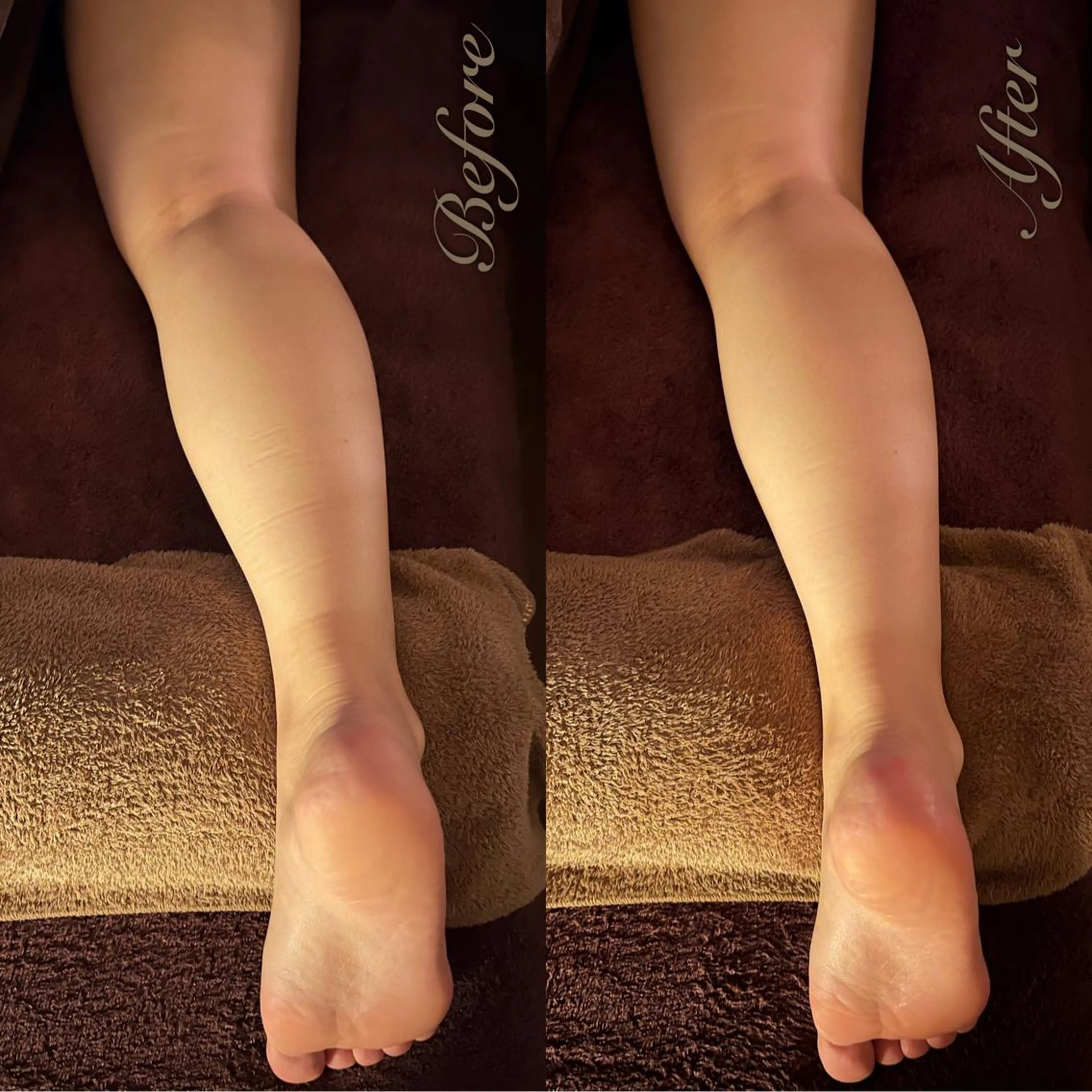 lymph care 'Welnəsのエステ・リラクイメージ