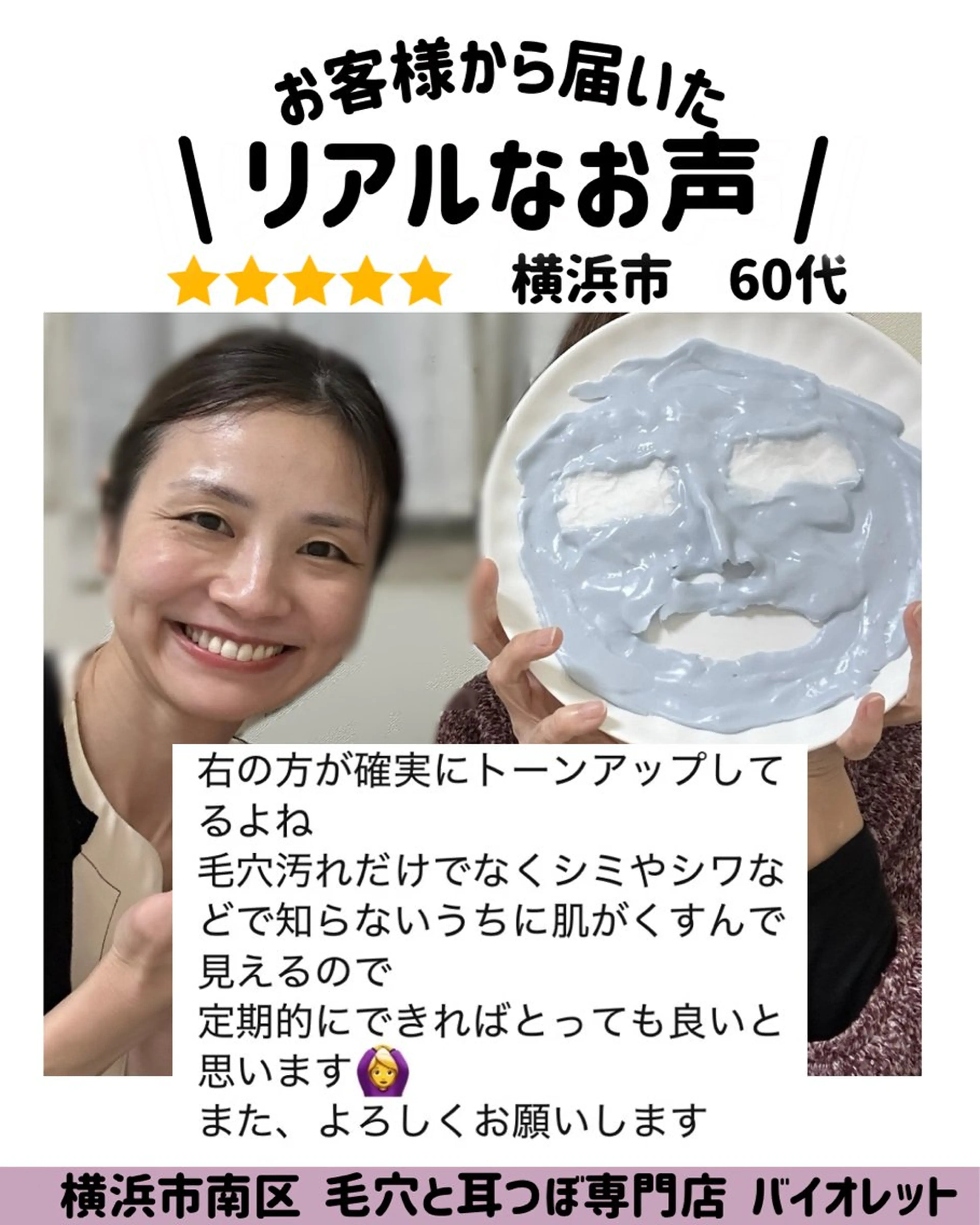 その他 毛穴と耳つぼ専門店 バイオレット　りののその他イメージ