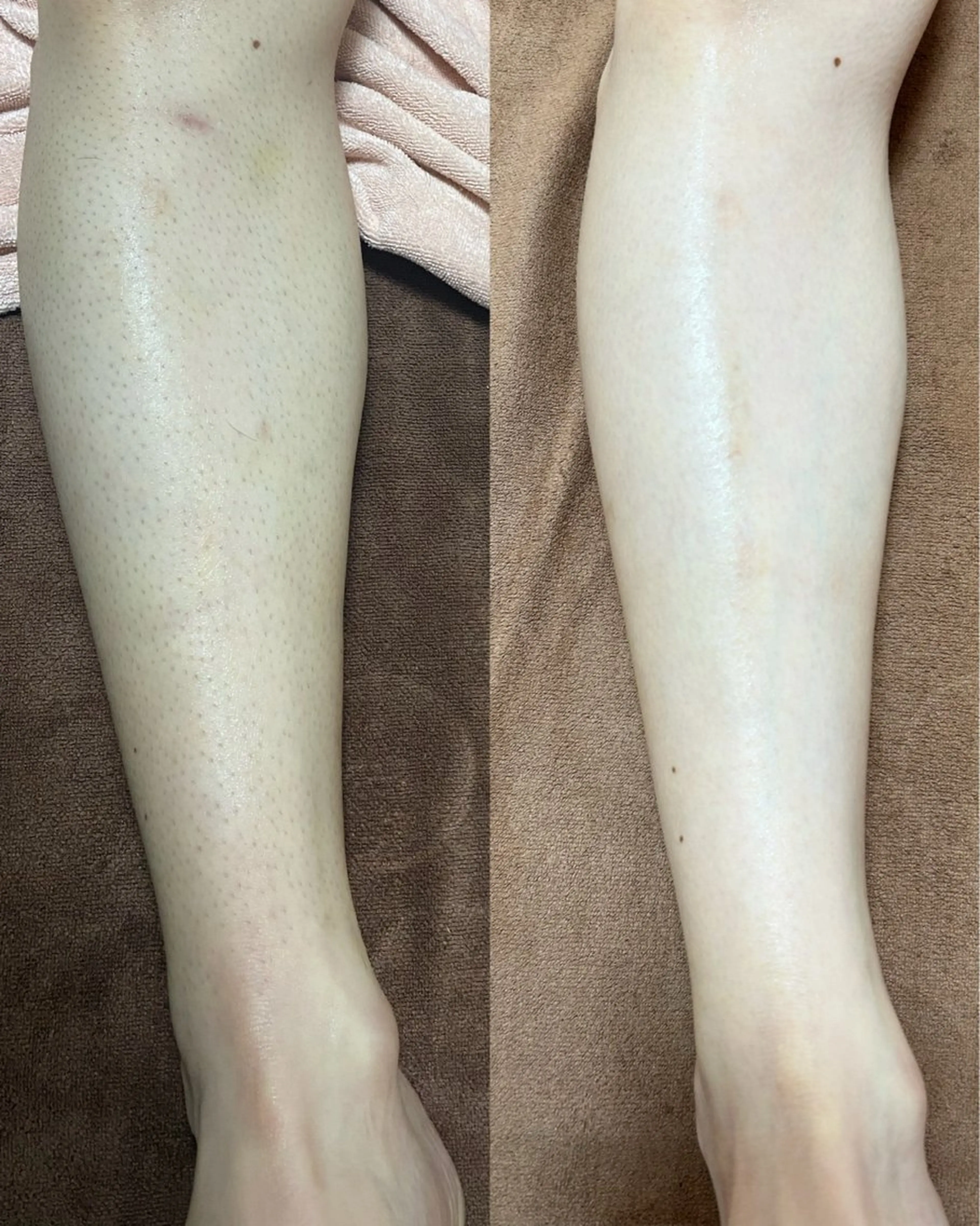 Be Charm 山﨑のエステ・リラクイメージ