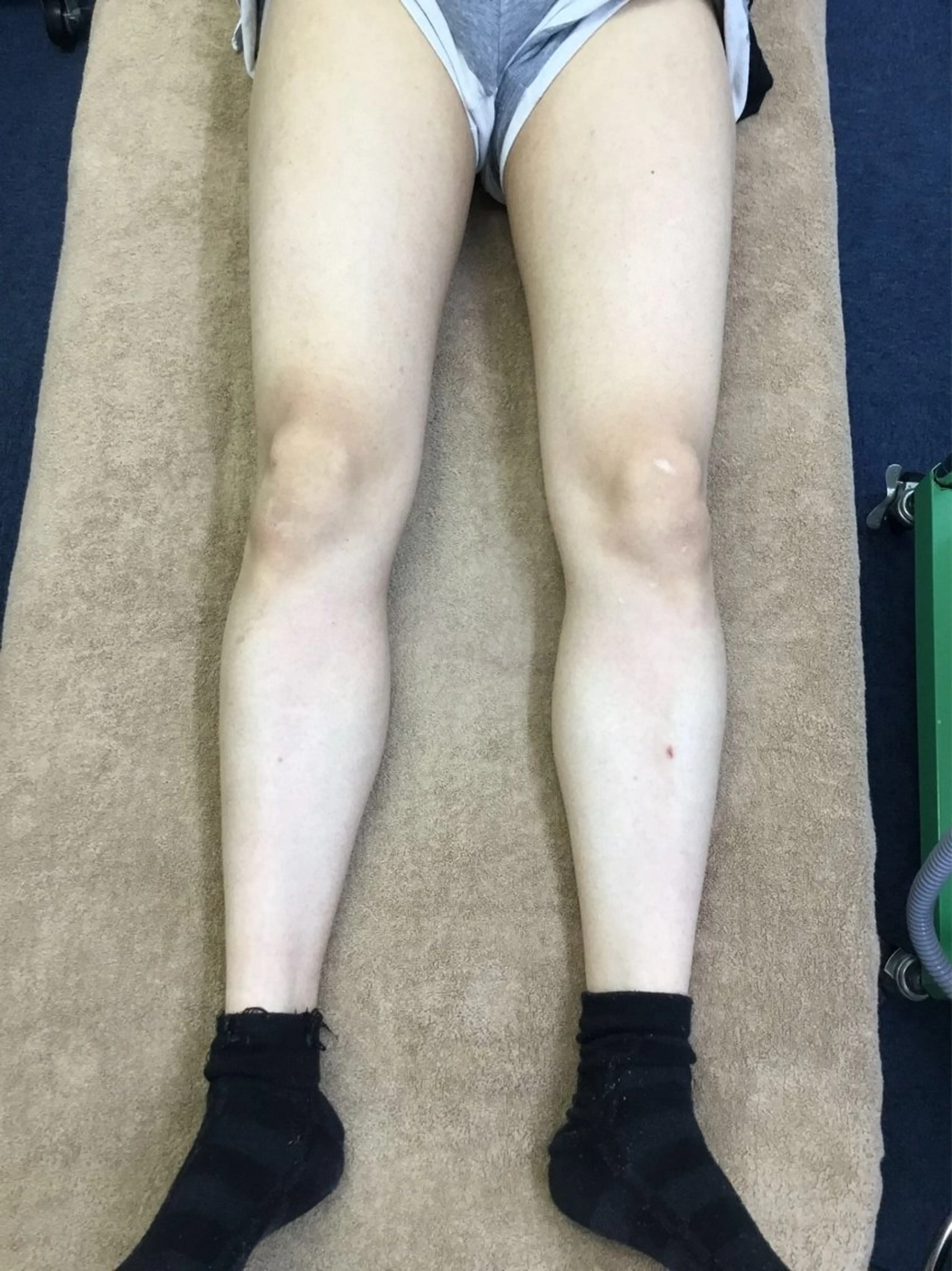 メンズ 脱毛 ☀️Akala☀️ メンズ脱毛のエステ・リラクイメージ