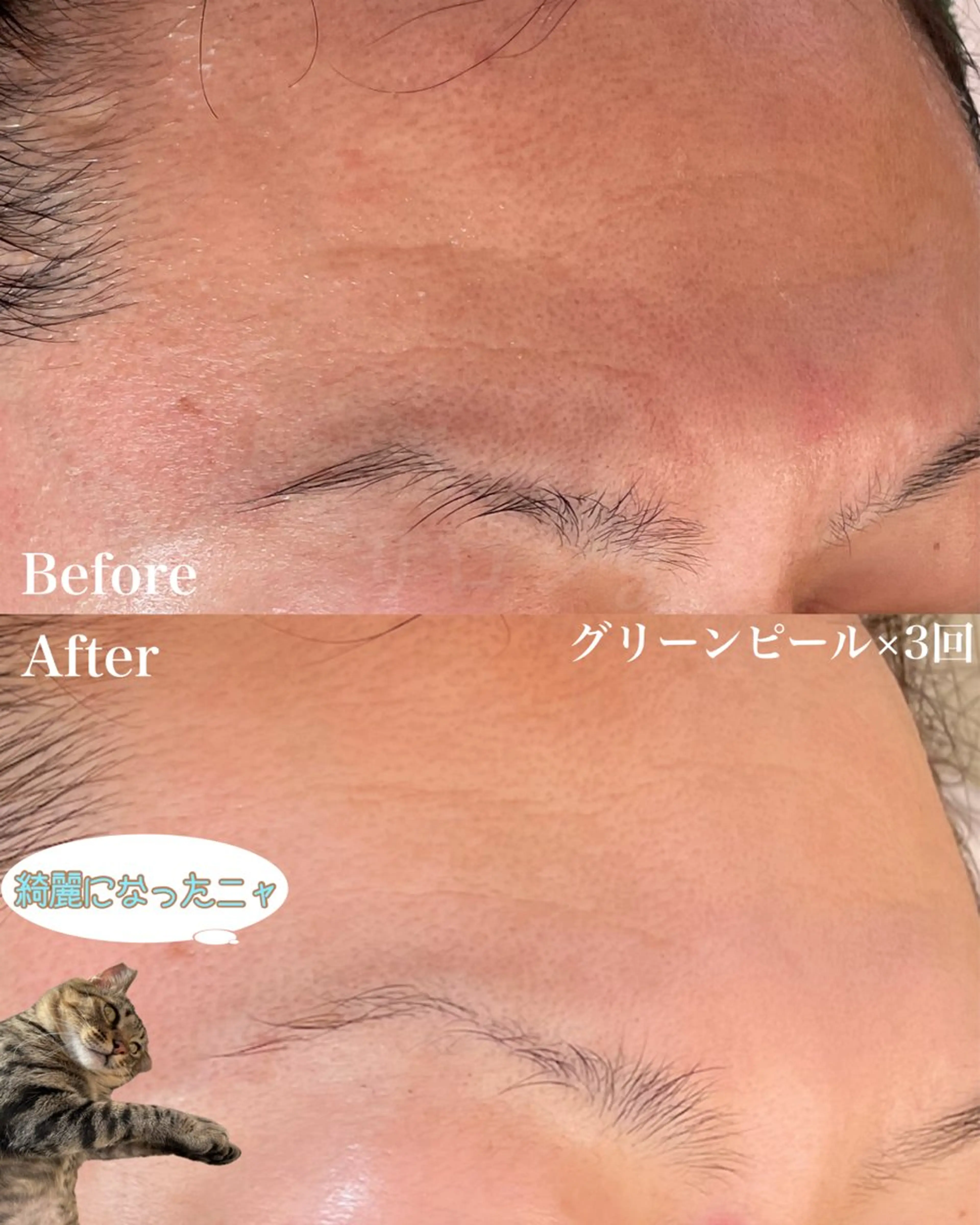 グリーンピール専門店 サロンY【大阪】のエステ・リラクイメージ