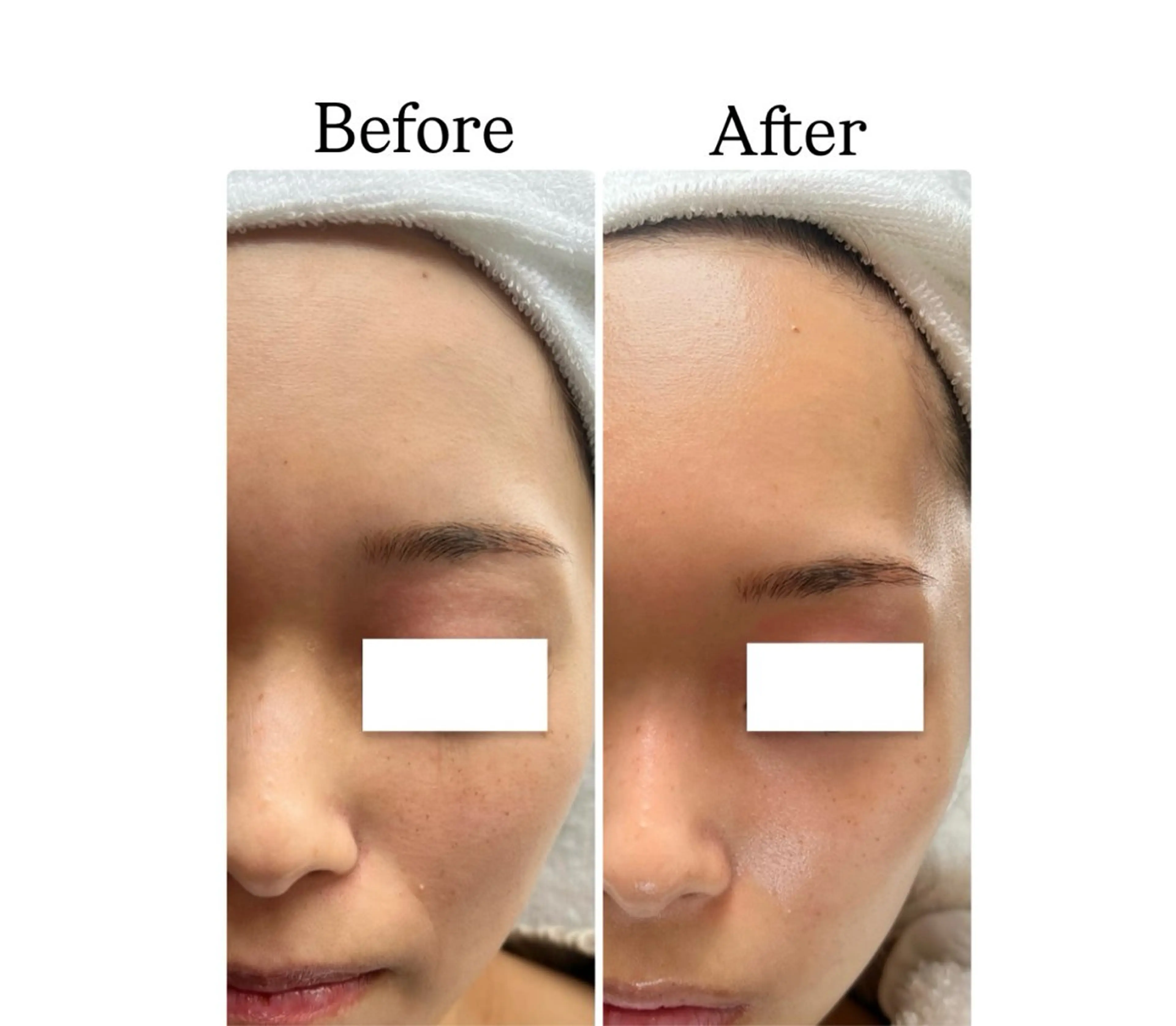 エステ ROR Akariのエステ・リラクイメージ