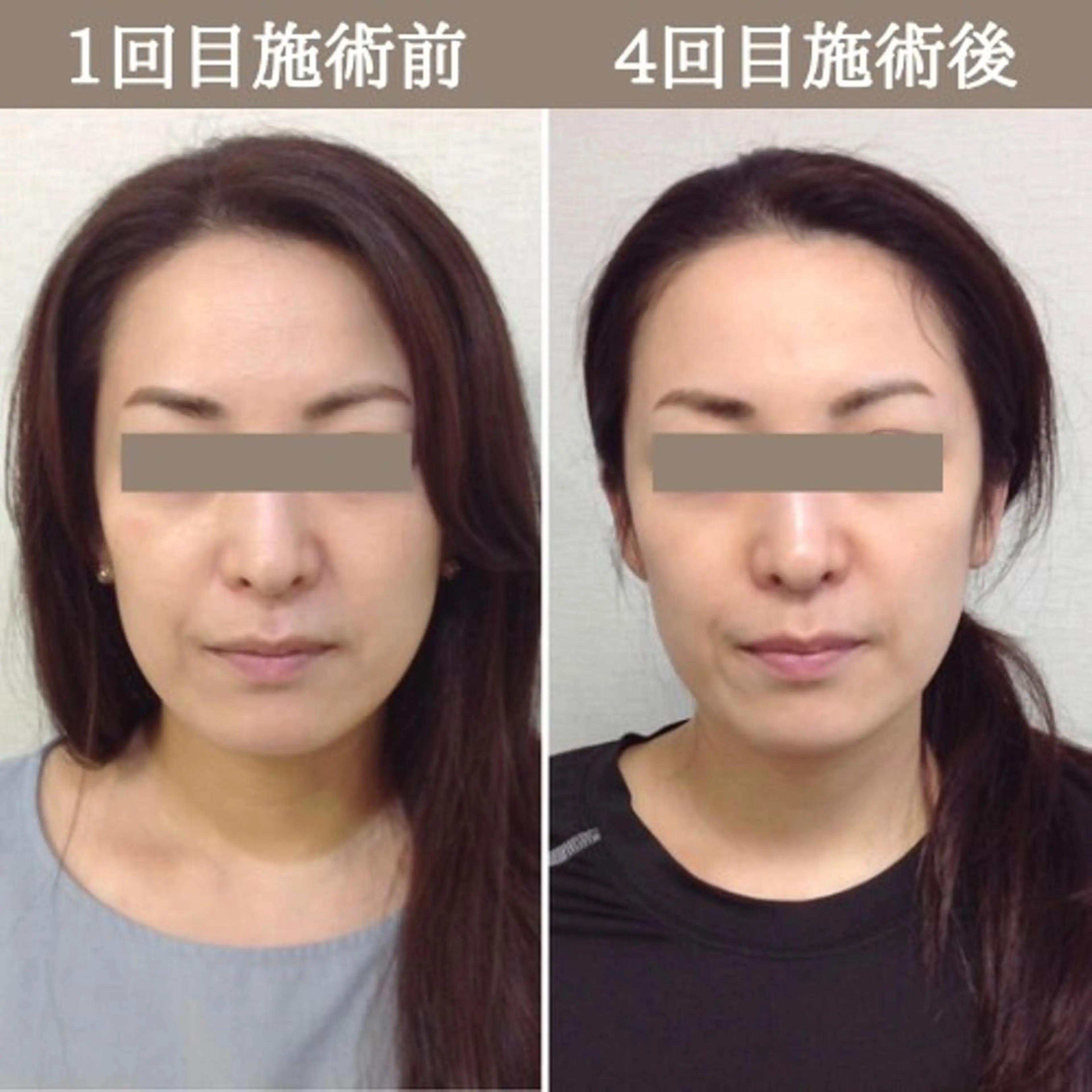 美容整体サロン Chare人形町店のエステ・リラクイメージ