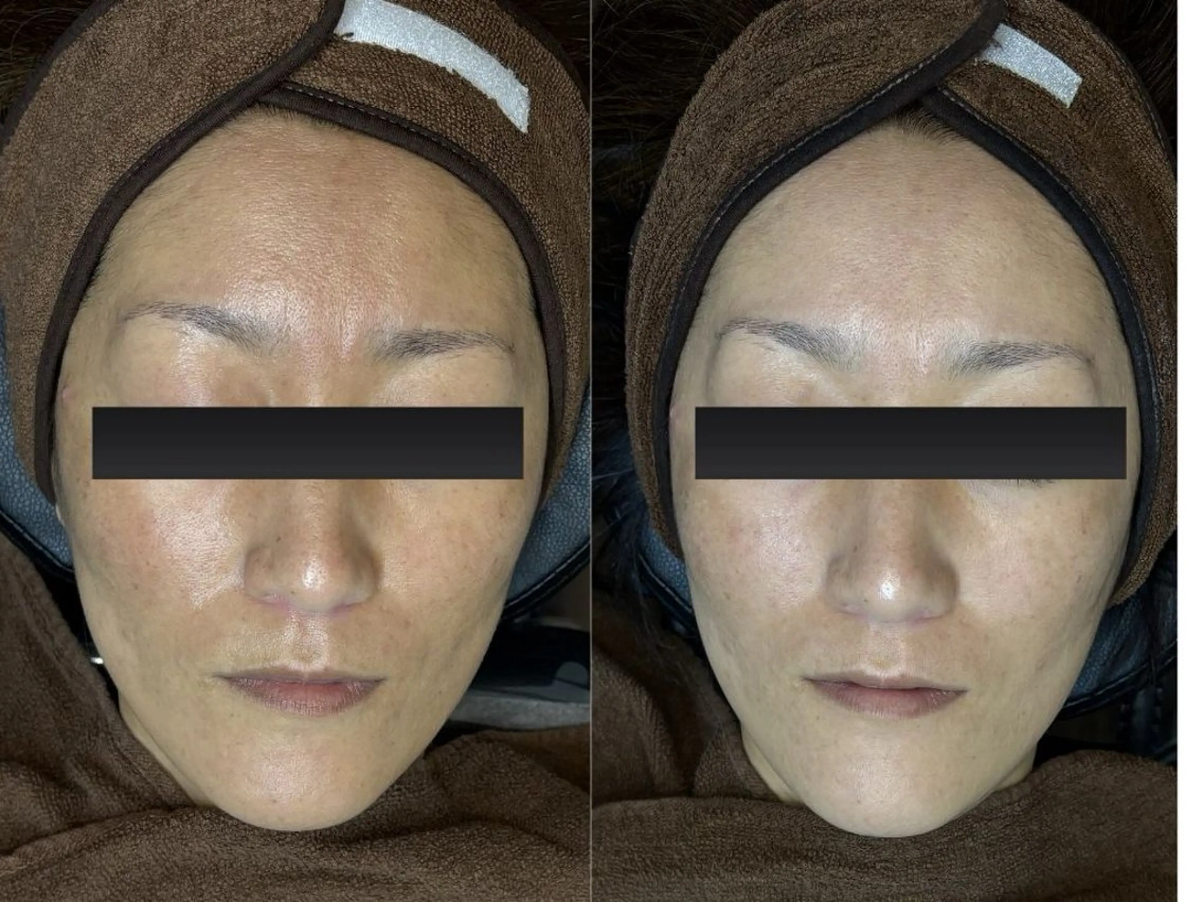 イルミナ 伊藤のエステ・リラクイメージ