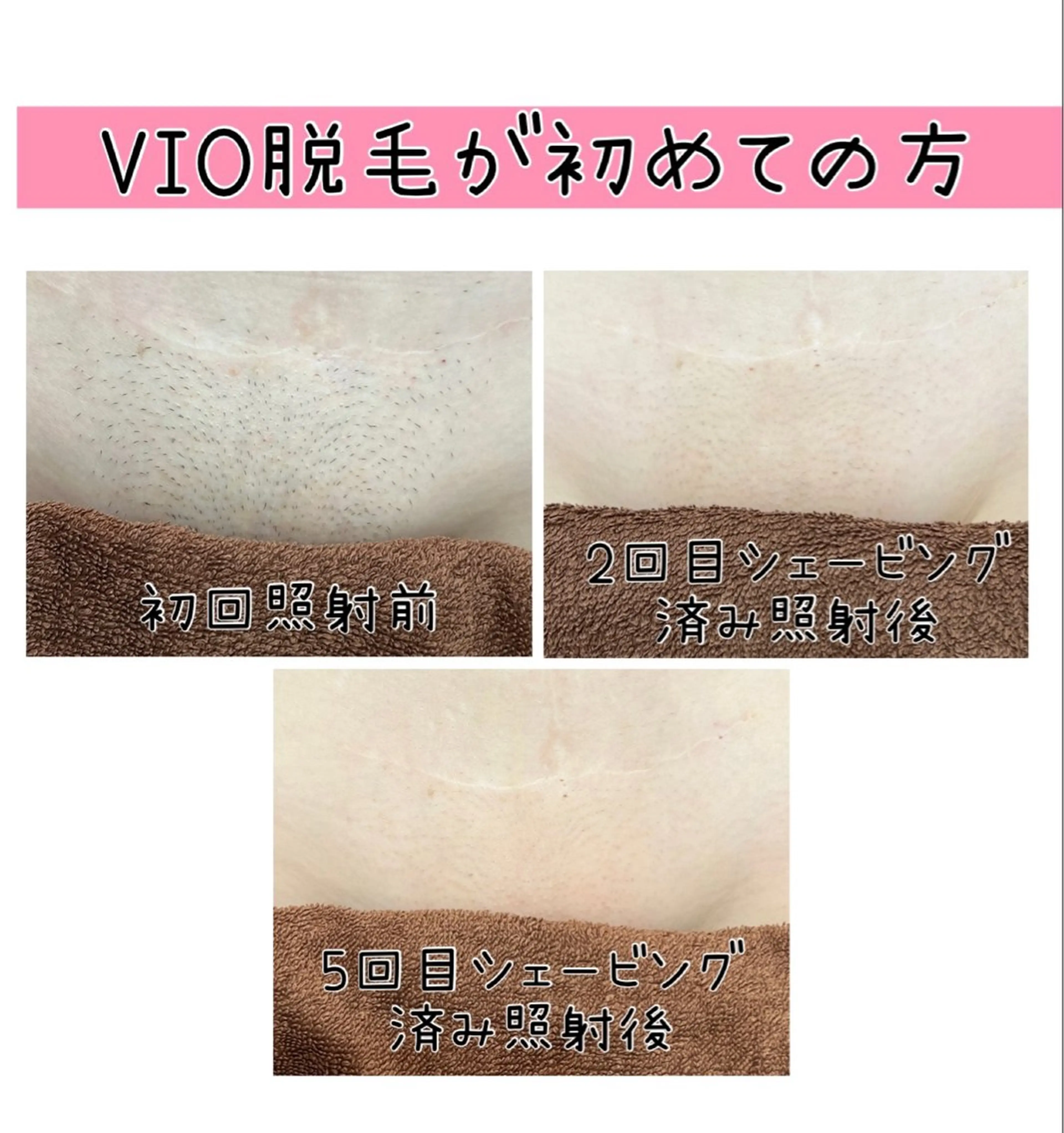 毛穴改善/脱毛 ネイル　川上久仁子のエステ・リラクイメージ