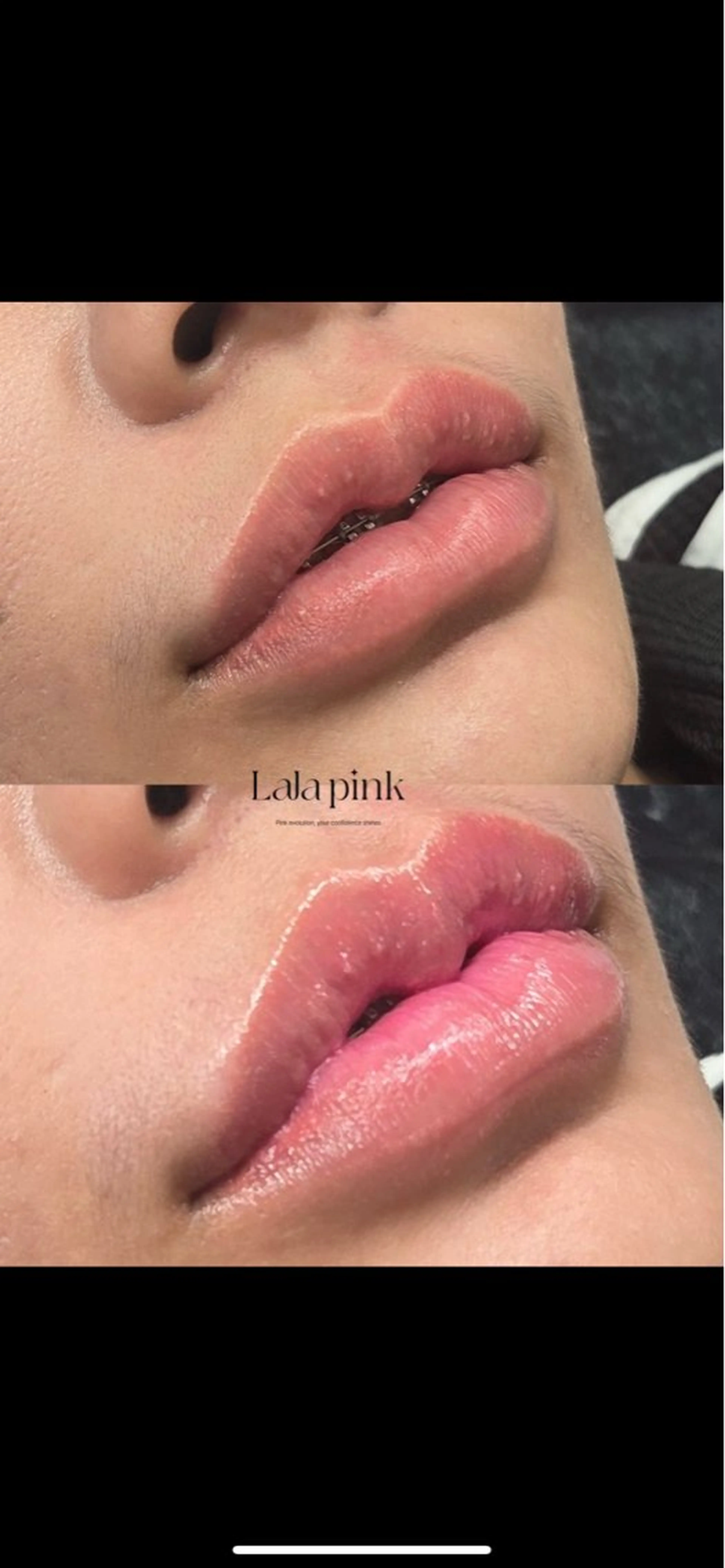 エステ KIRAN 山﨑のエステ・リラクイメージ