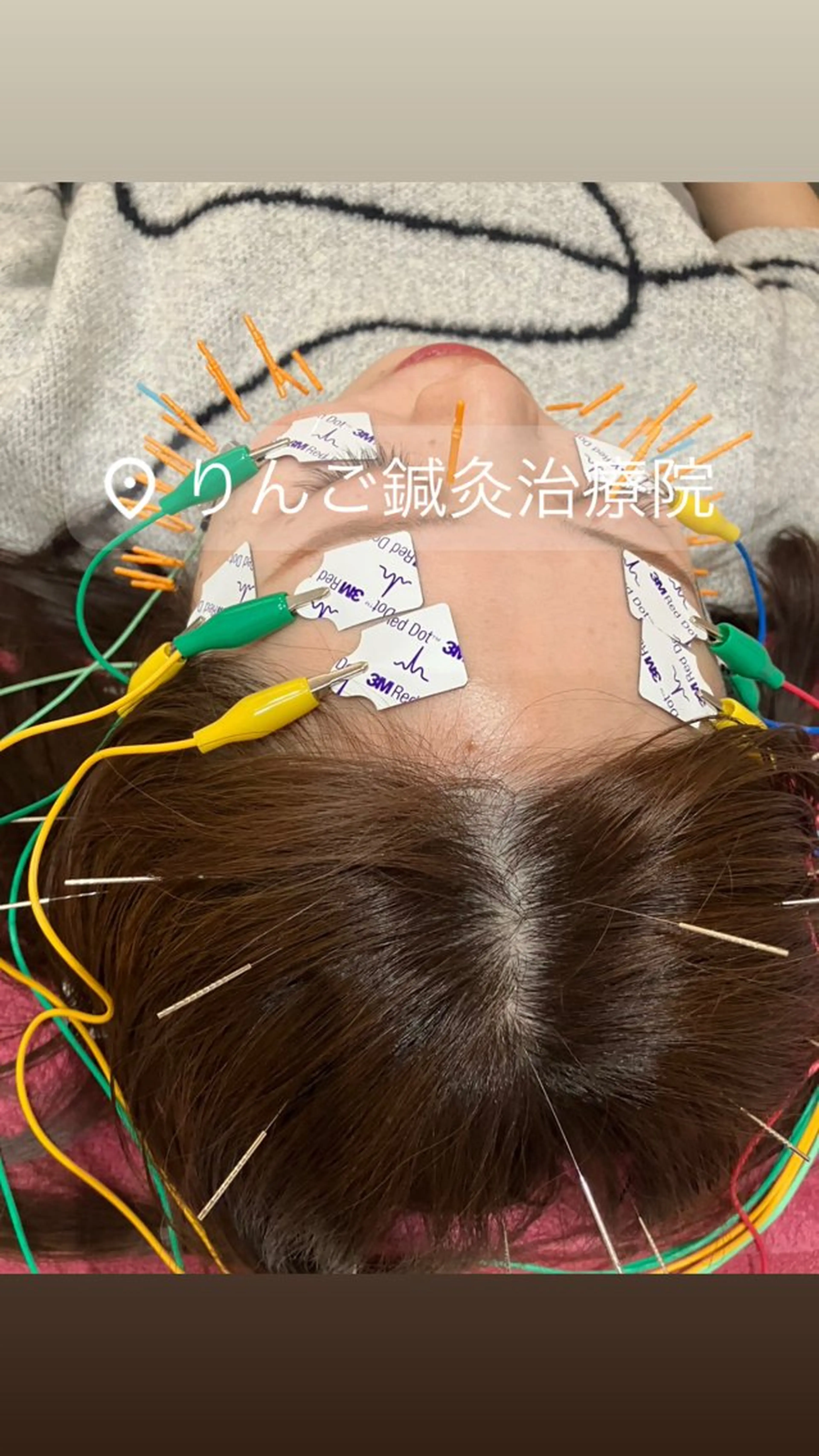 その他 美容鍼灸女性専用 りんご鍼灸治療院のその他イメージ