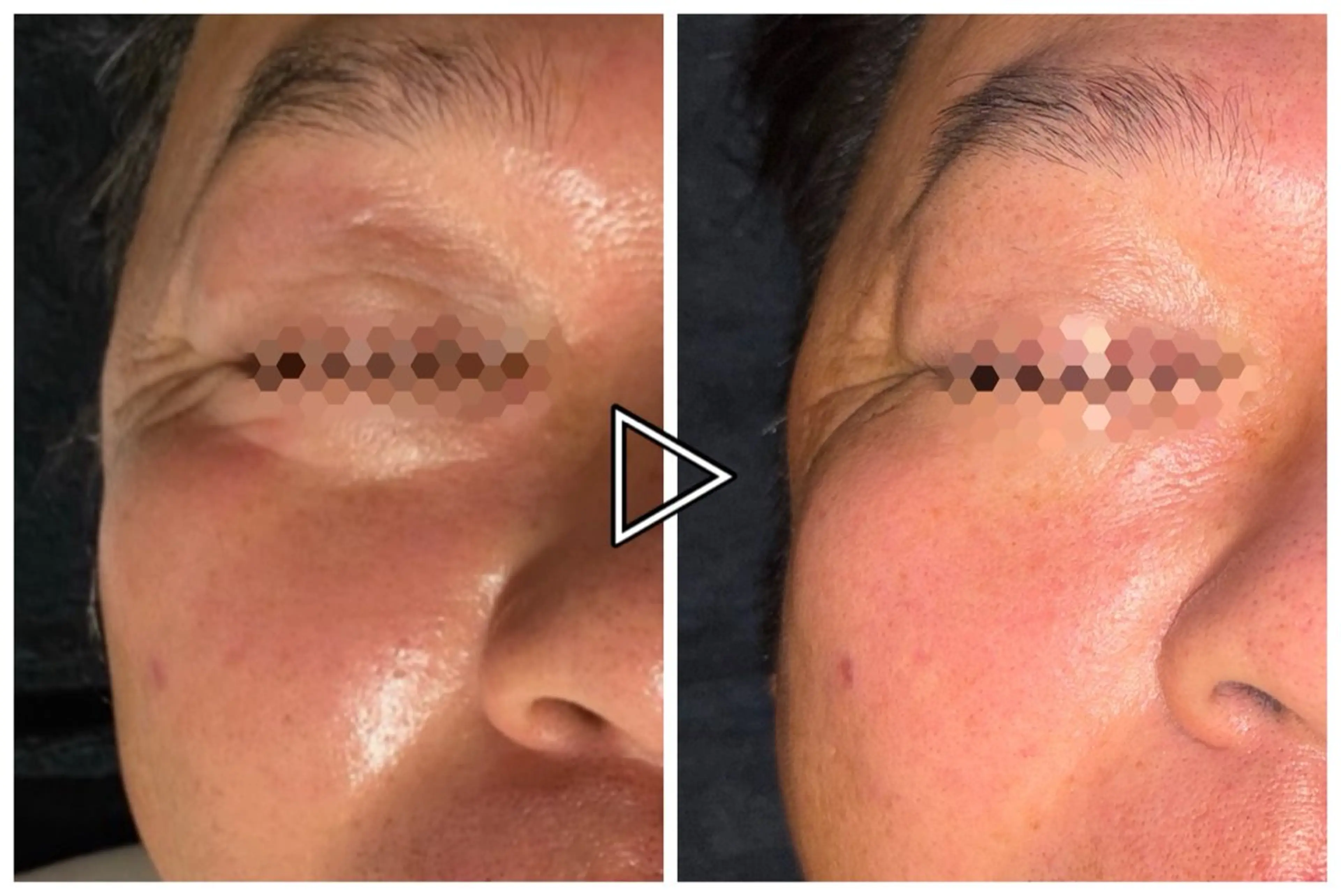 エステ monselvi/モンセルヴィ所属・monselvi 上前津エステのエステ・リラクイメージ