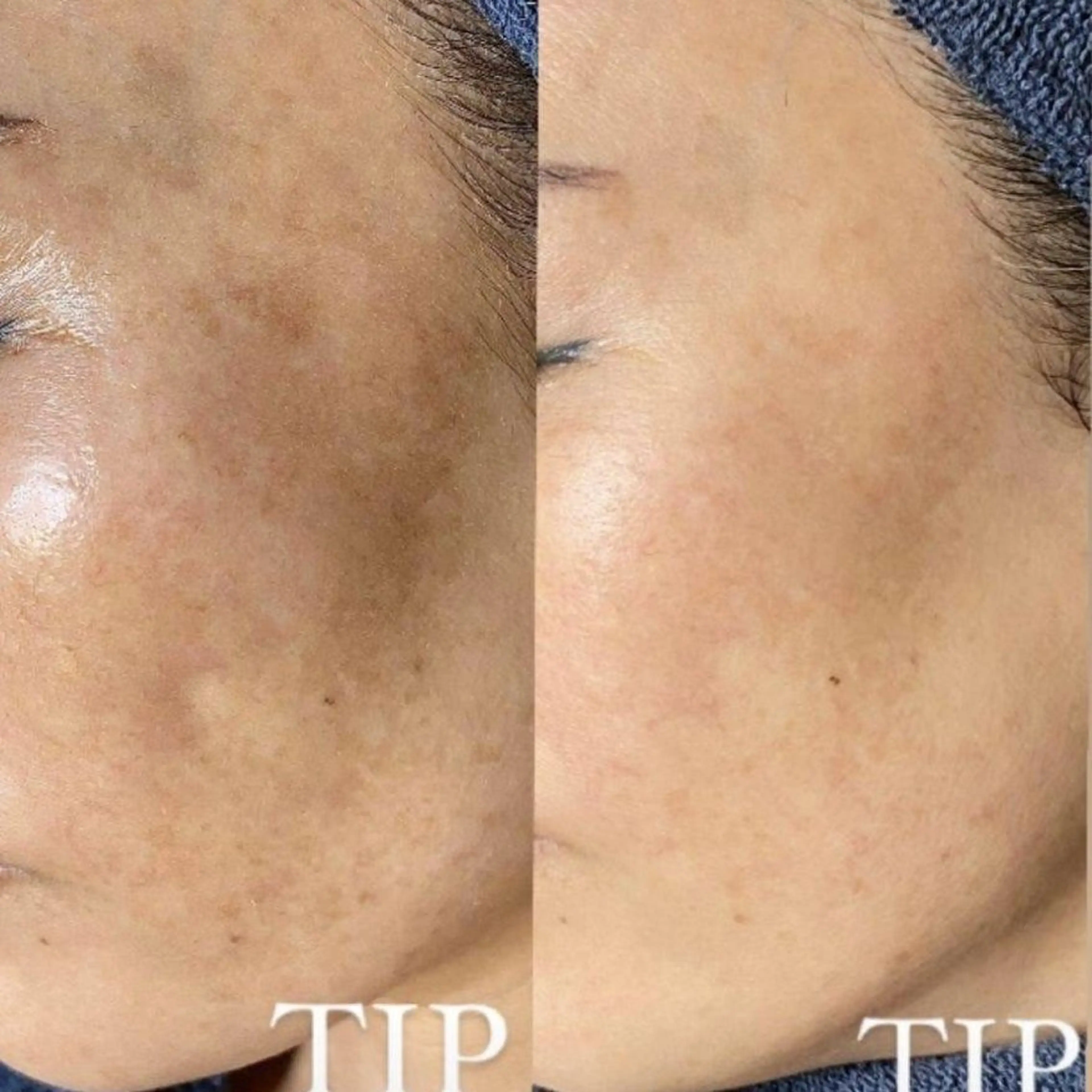 エステ Ellebeauty relaxationのエステ・リラクイメージ