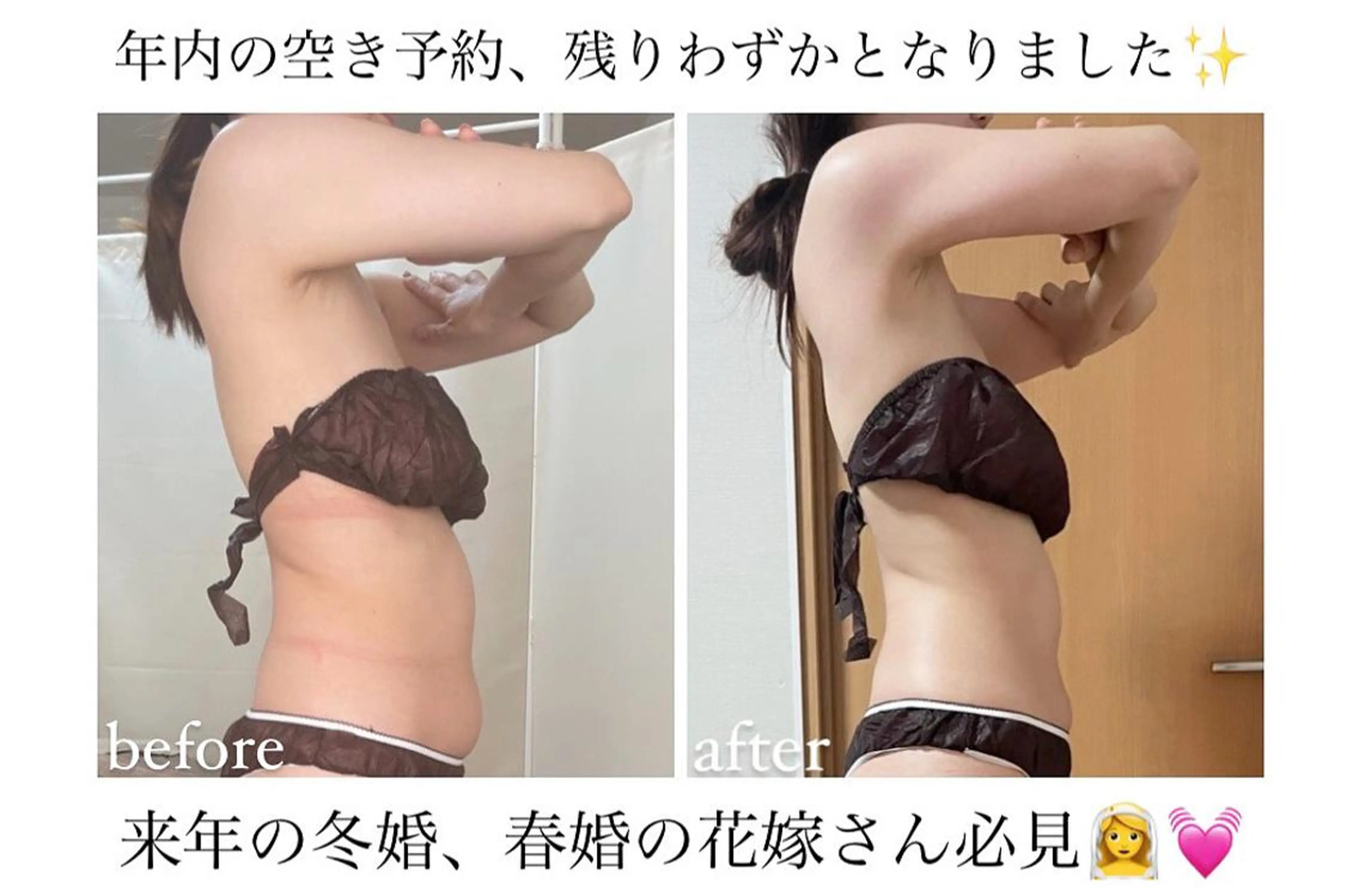 biloop所属・《本気痩せ×疲労改善 》  BILOOPのエステ・リラクイメージ