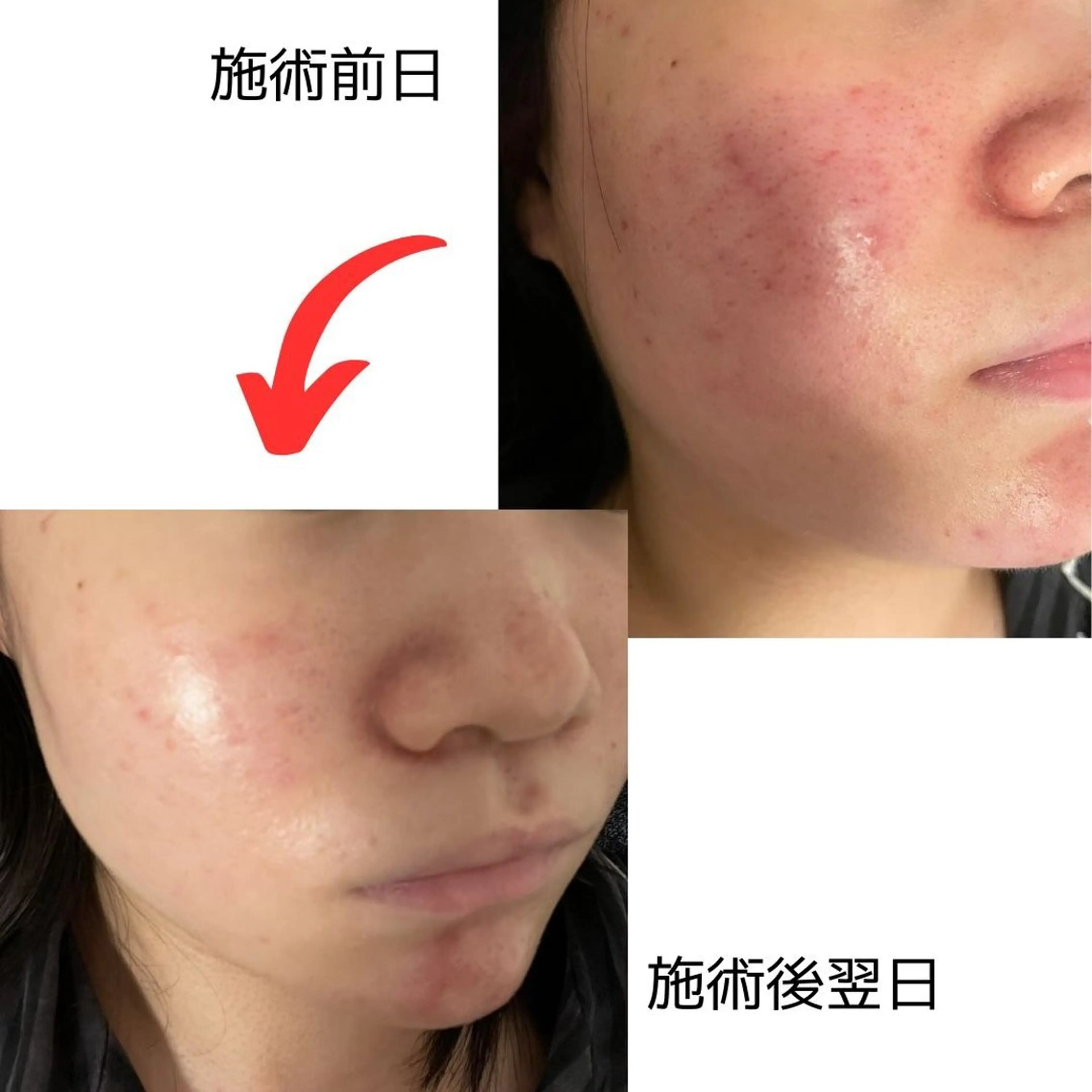 脱毛 彭 伸子のエステ・リラクイメージ