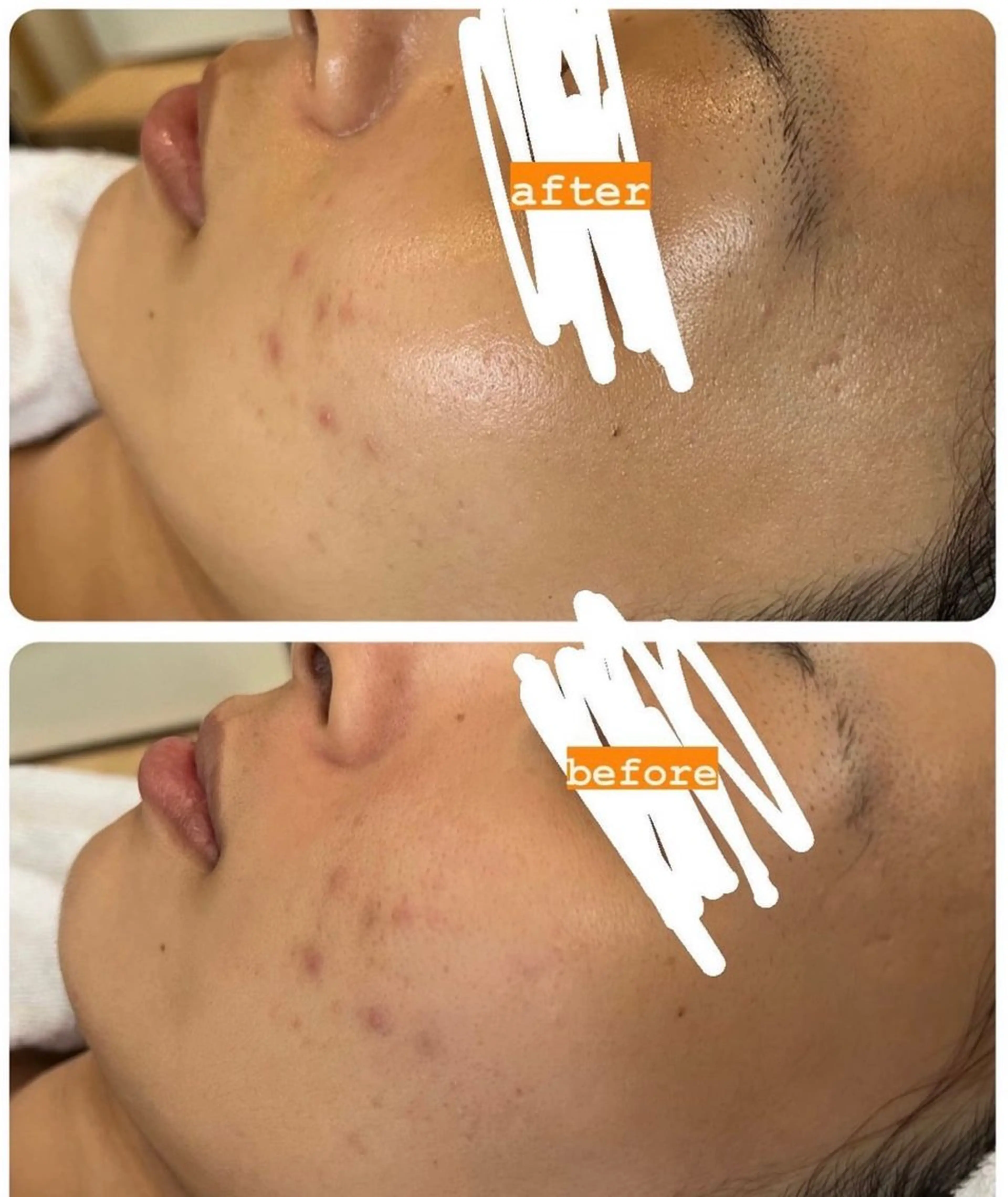 エステ 若返り❤️ エステサロン❤️のその他イメージ