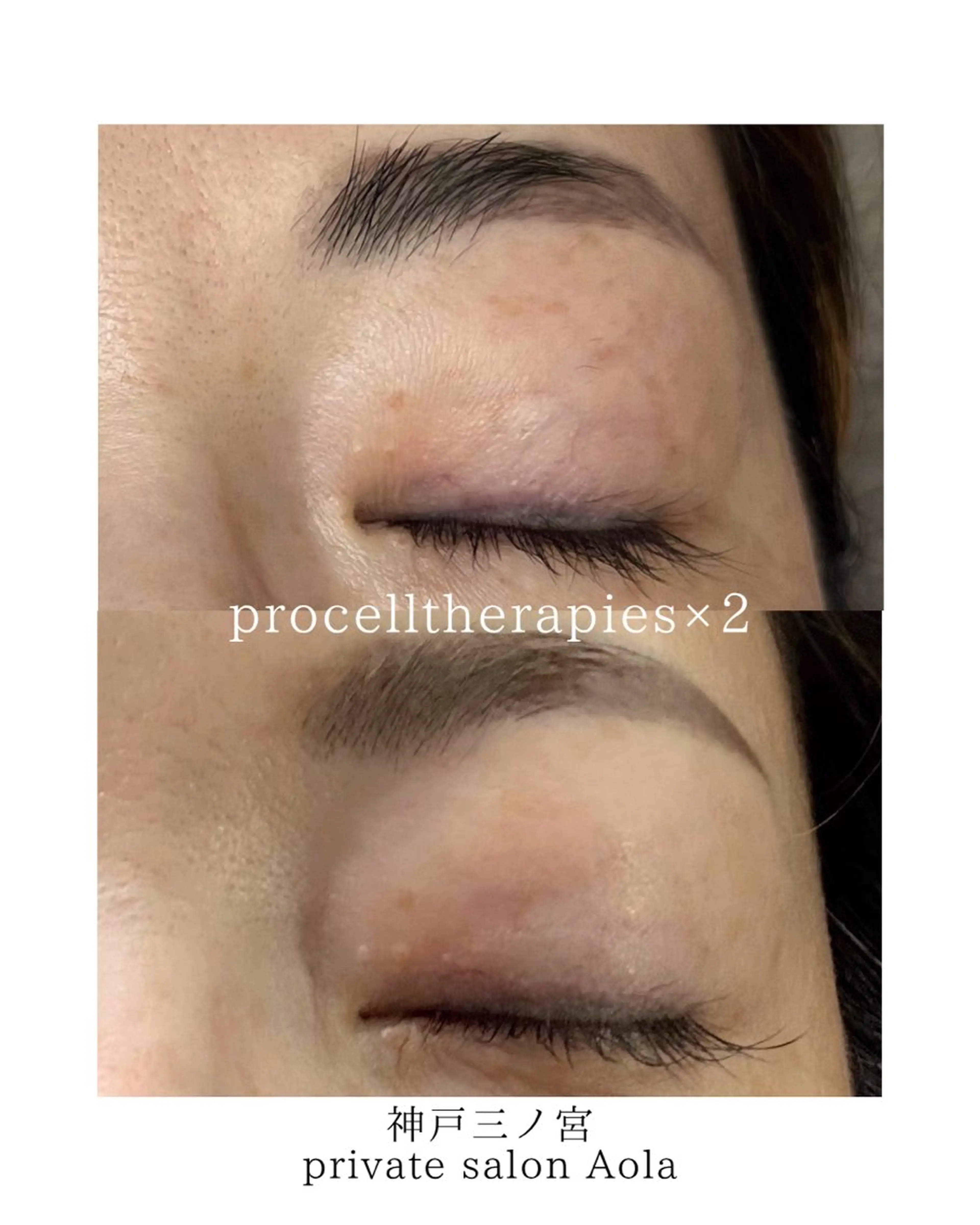 プライベートサロン アオラのネイルデザイン