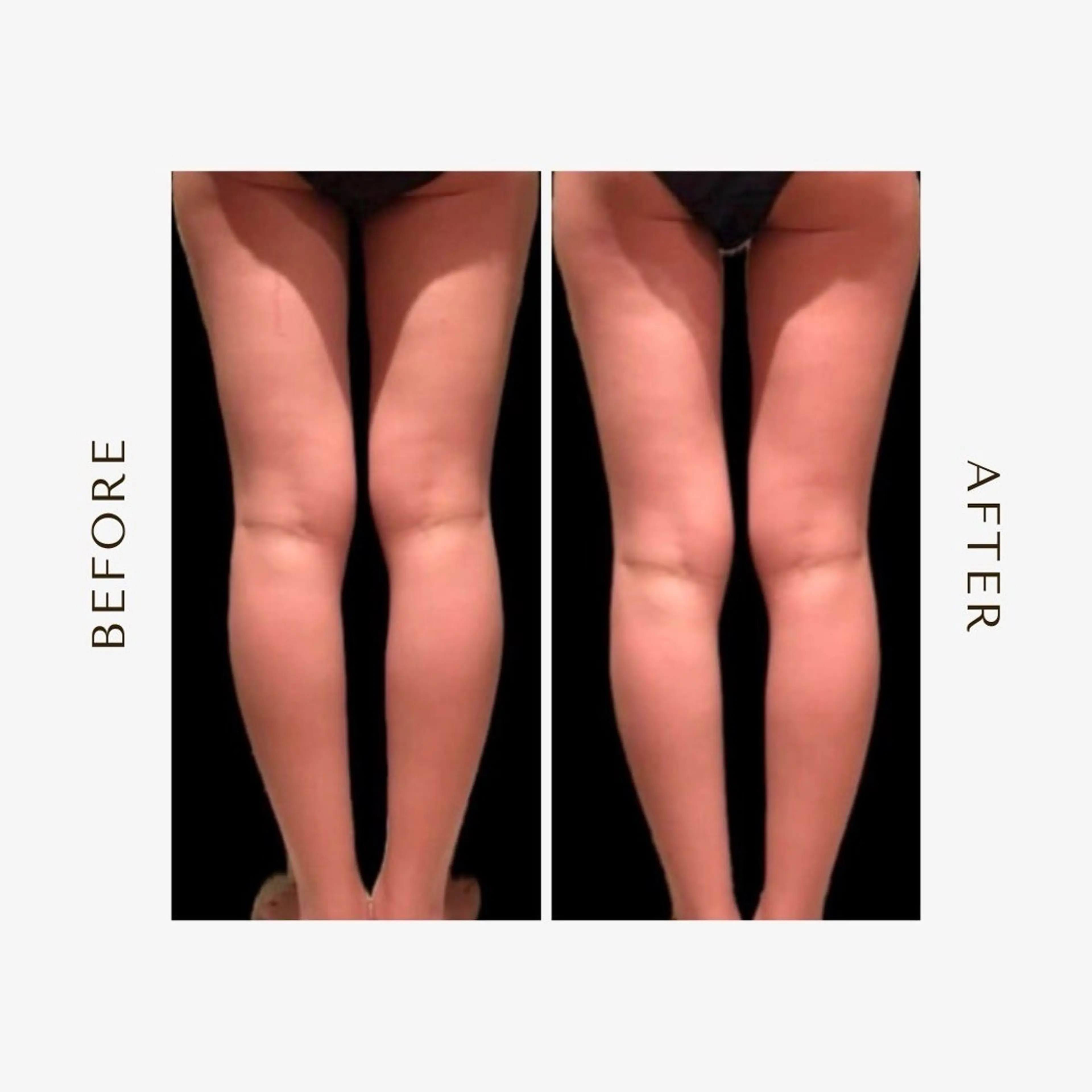 新規限定♥【下半身を何とかしたい！】足痩せコースの写真