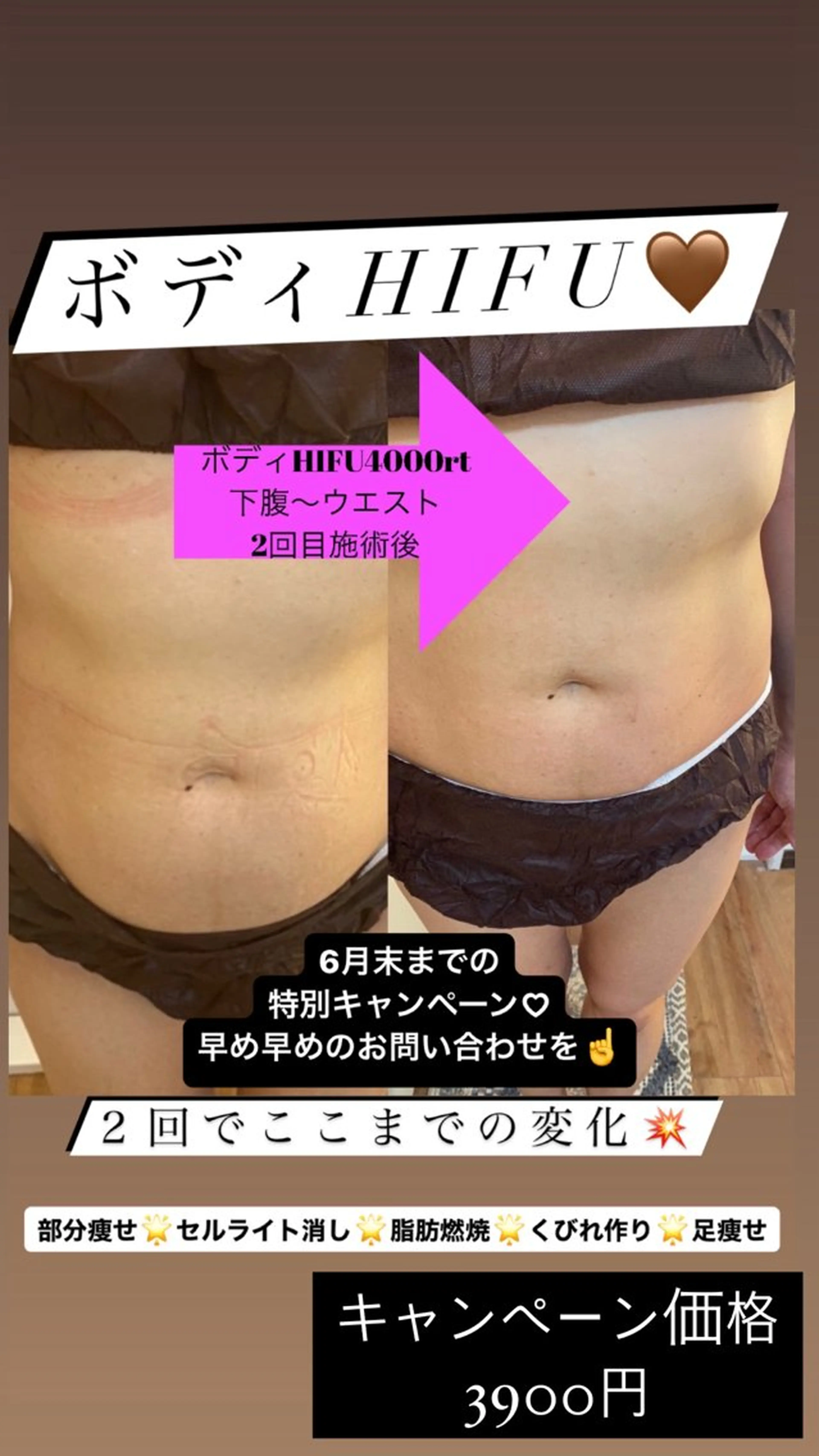 VERY VERY 九条店のエステ・リラクイメージ