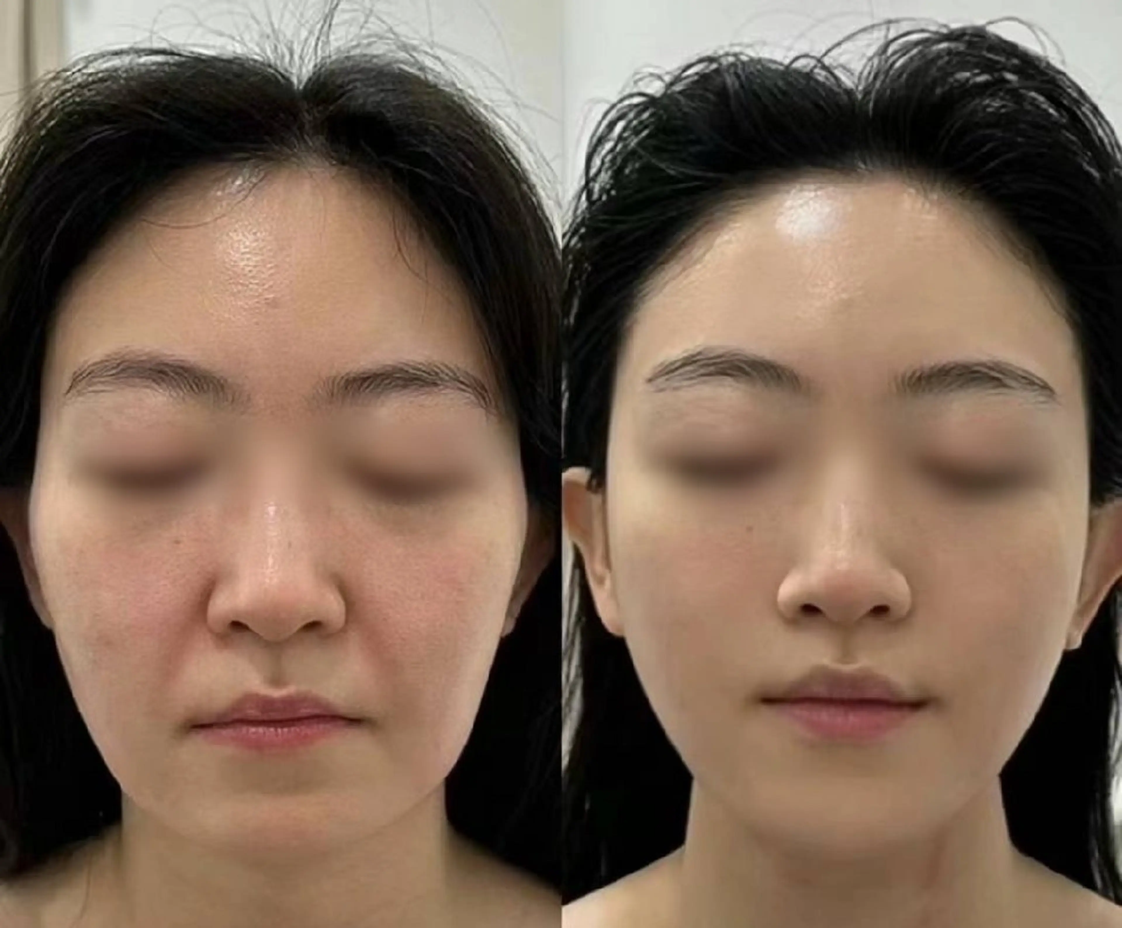 マツエク・マツパ 結婚式・ブライダル aliaハーブ水光店 エステティシャン募集のエステ・リラクイメージ