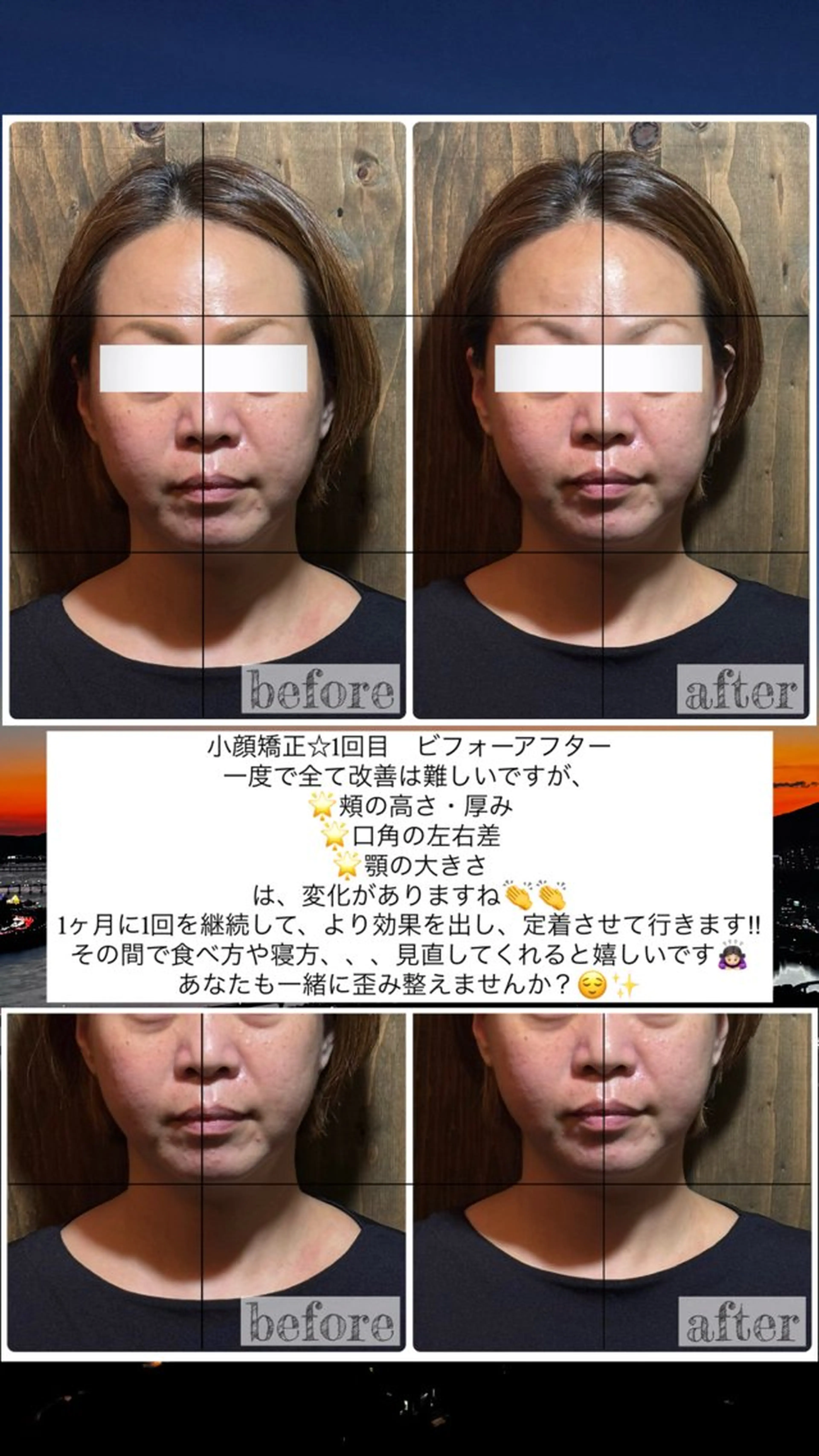 エステ リラク 💎後悔させない小顔 矯正💎イトヤマ🌱のエステ・リラクイメージ