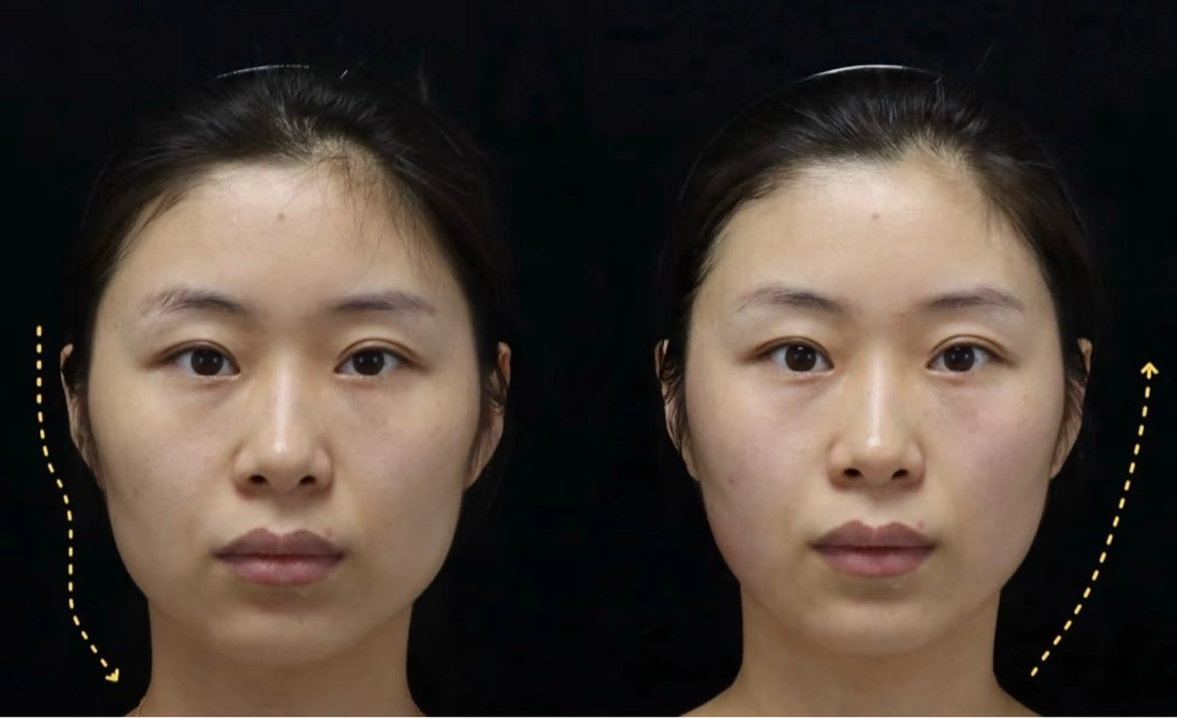 マツエク・マツパ エステ リラク 愛維美水光美肌専門店 メンズレディースokのエステ・リラクイメージ