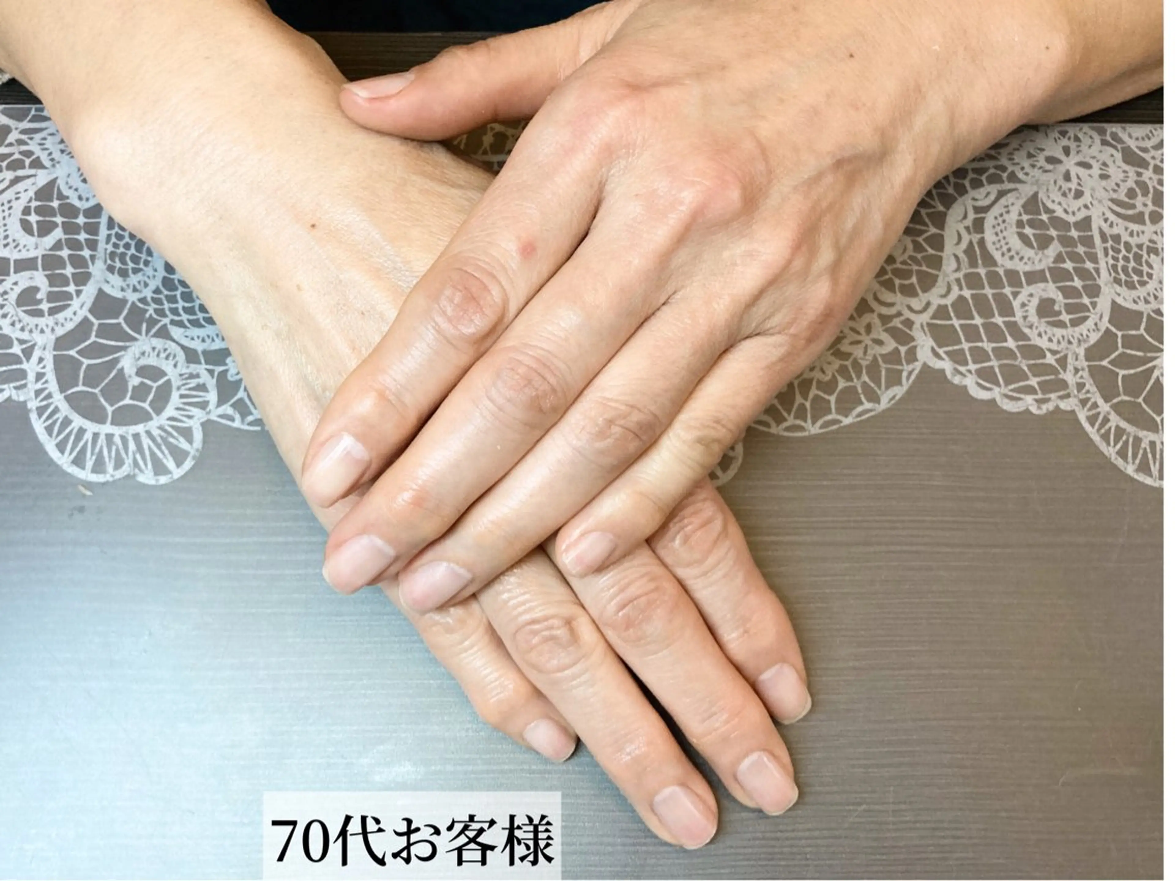 【手のしわ改善】ハンドケア＆ネイルケア　エイジングケア🌿120分(初回相談込み) 手の老化対策の写真