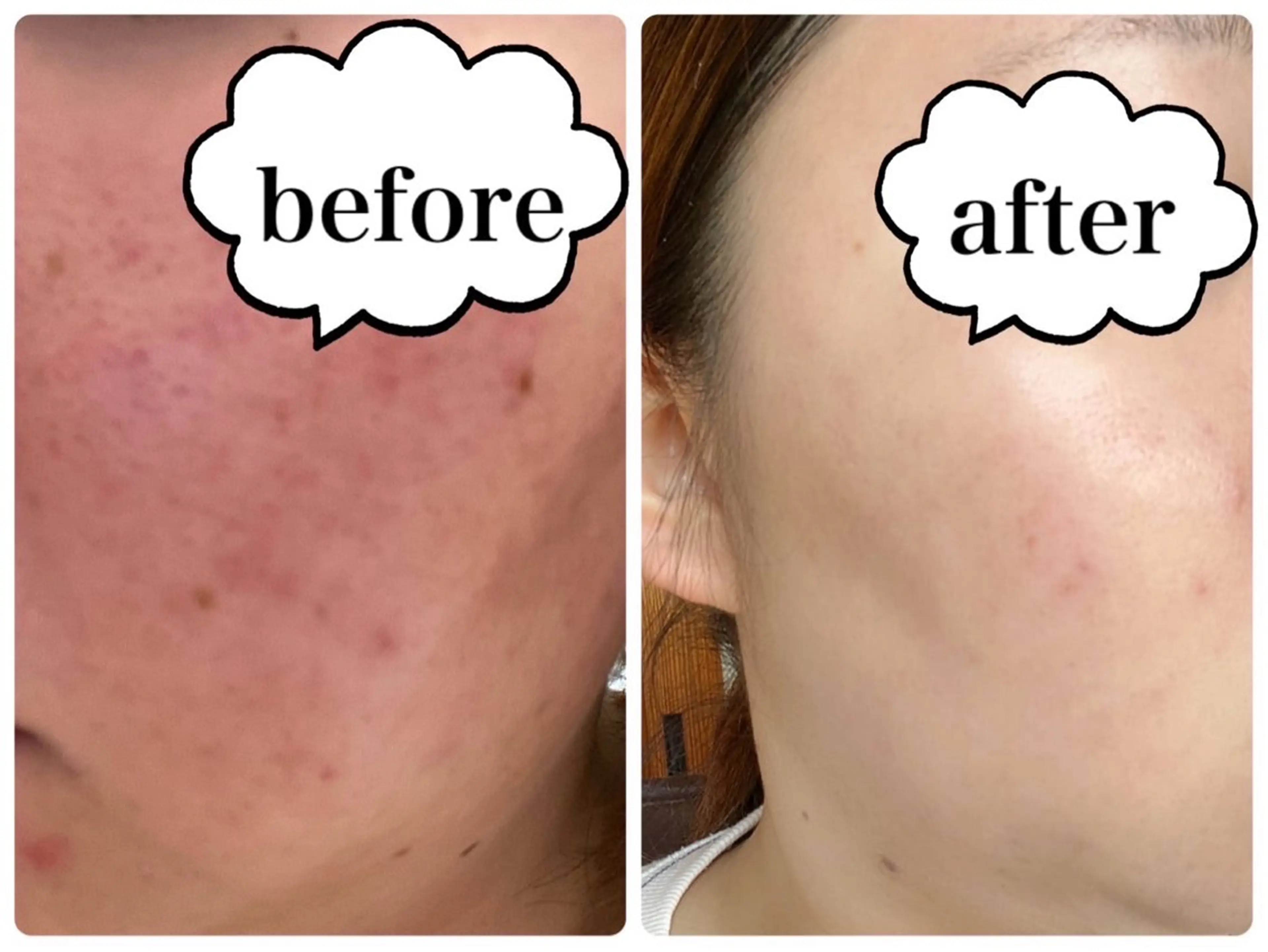 【人気No.1】オーダーメイドフルコース🌈ご自身の肌状態を知りたい人やお任せしたい！という方にオススメの写真