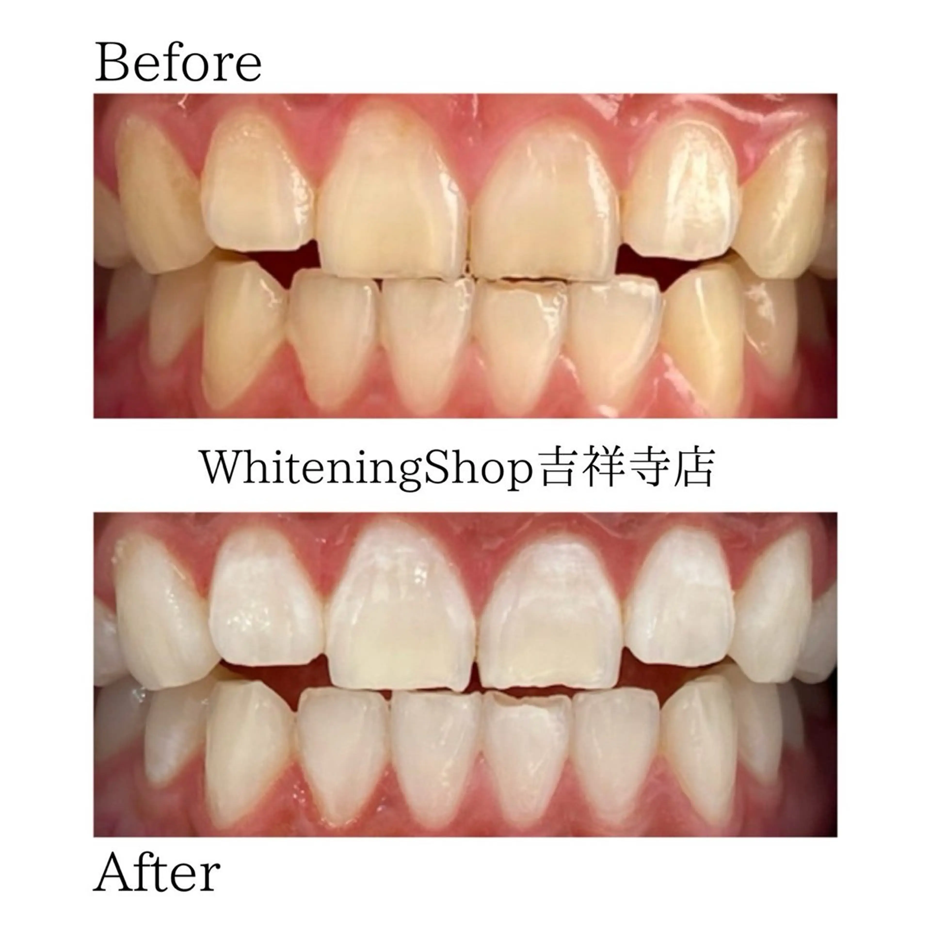 ホワイトニング ショップ吉祥寺店のエステ・リラクイメージ