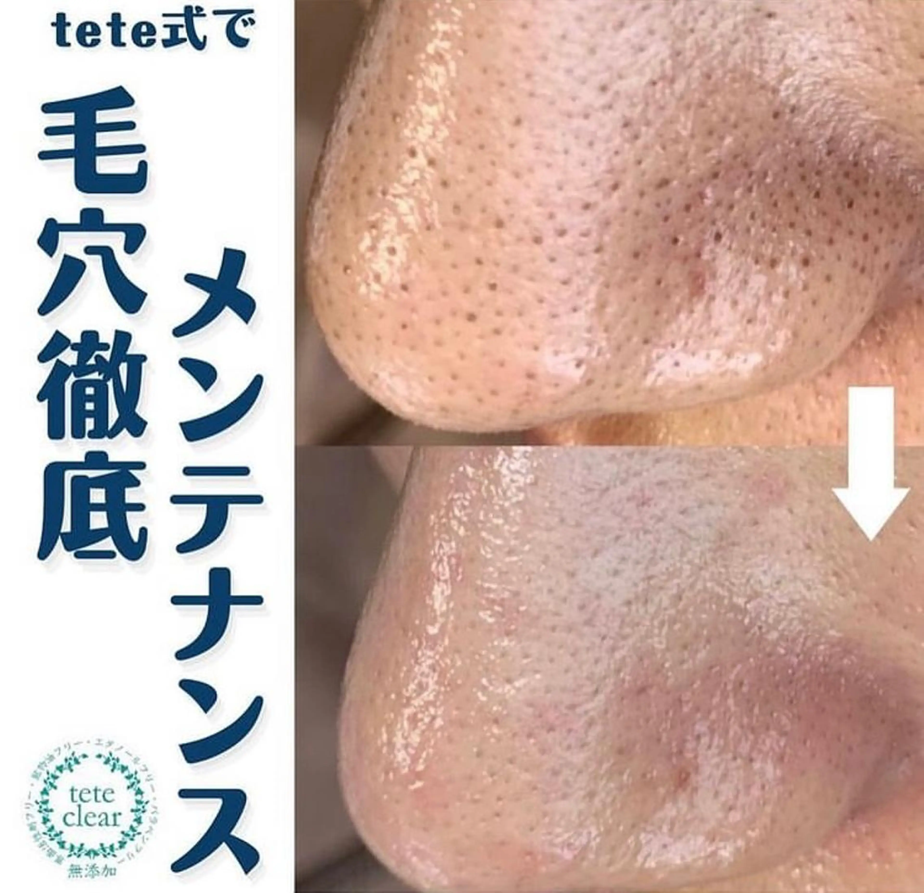 毛穴肌質ケアサロン Yourmeユアミーのエステ・リラクイメージ