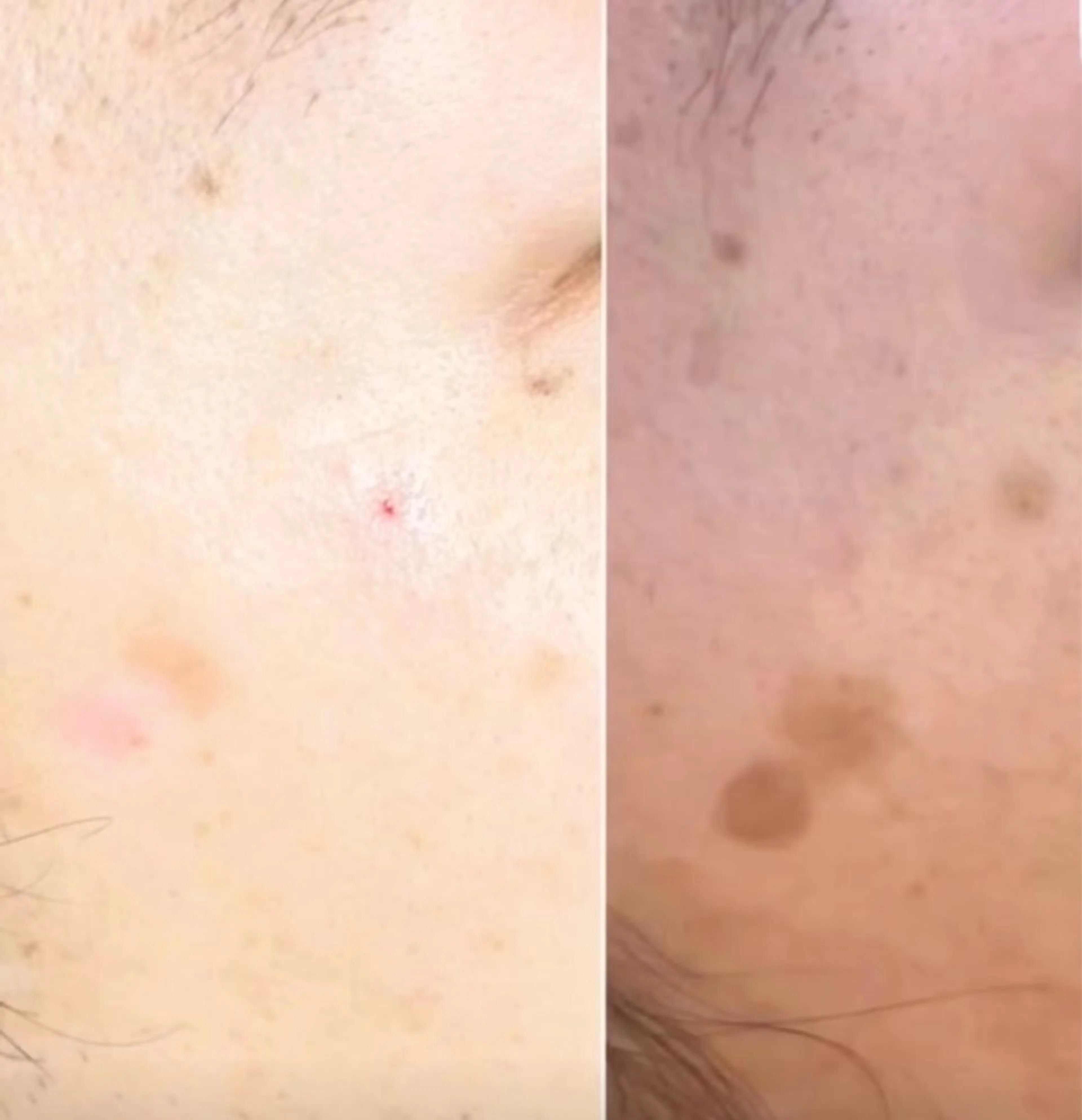 毛穴・シミ専門サロン ルパークのエステ・リラクイメージ