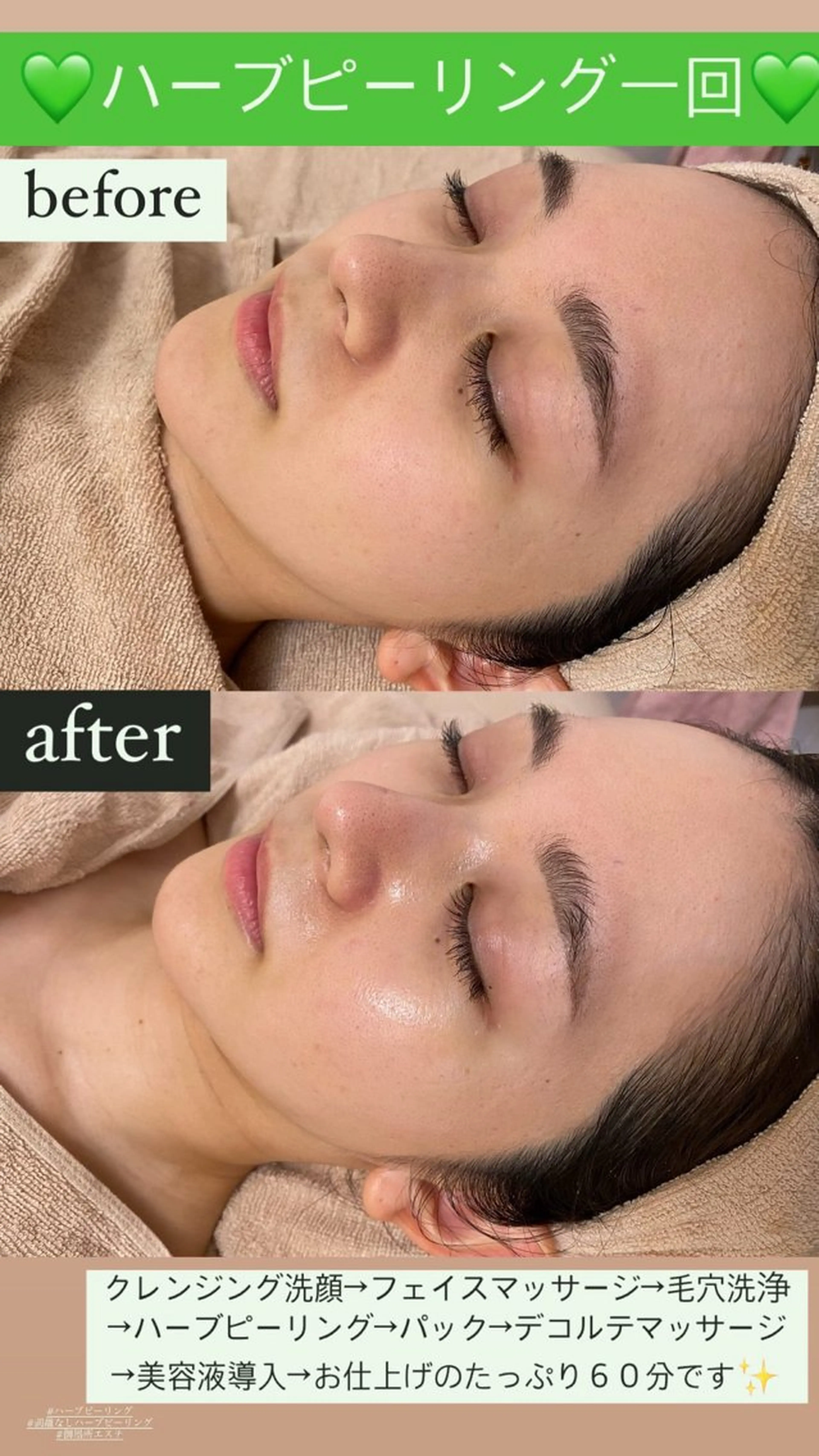 エステ Salon de Lino 御器所のエステ・リラクイメージ