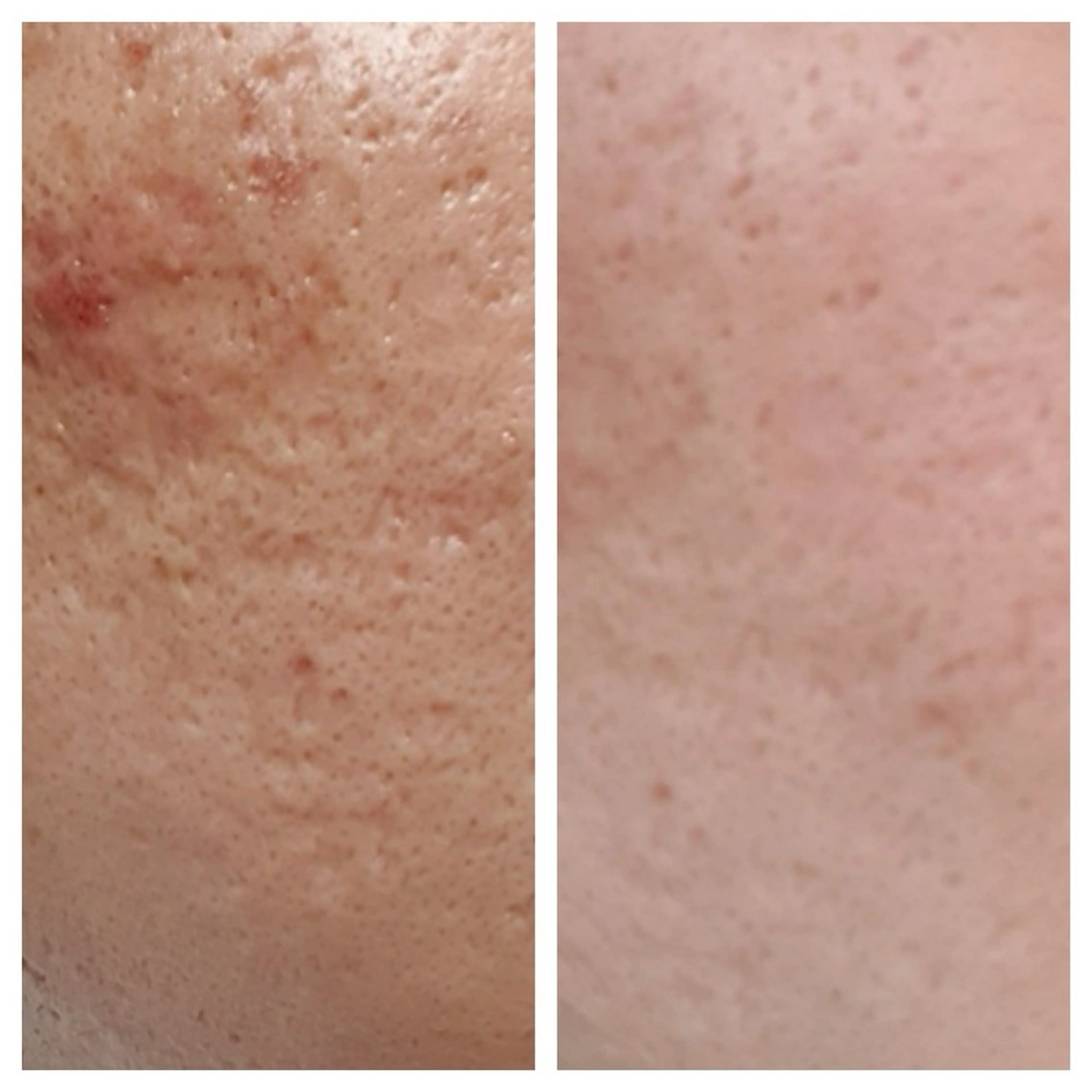 エステ 看護師が施術する美容 ナスサロ/matsuのエステ・リラクイメージ