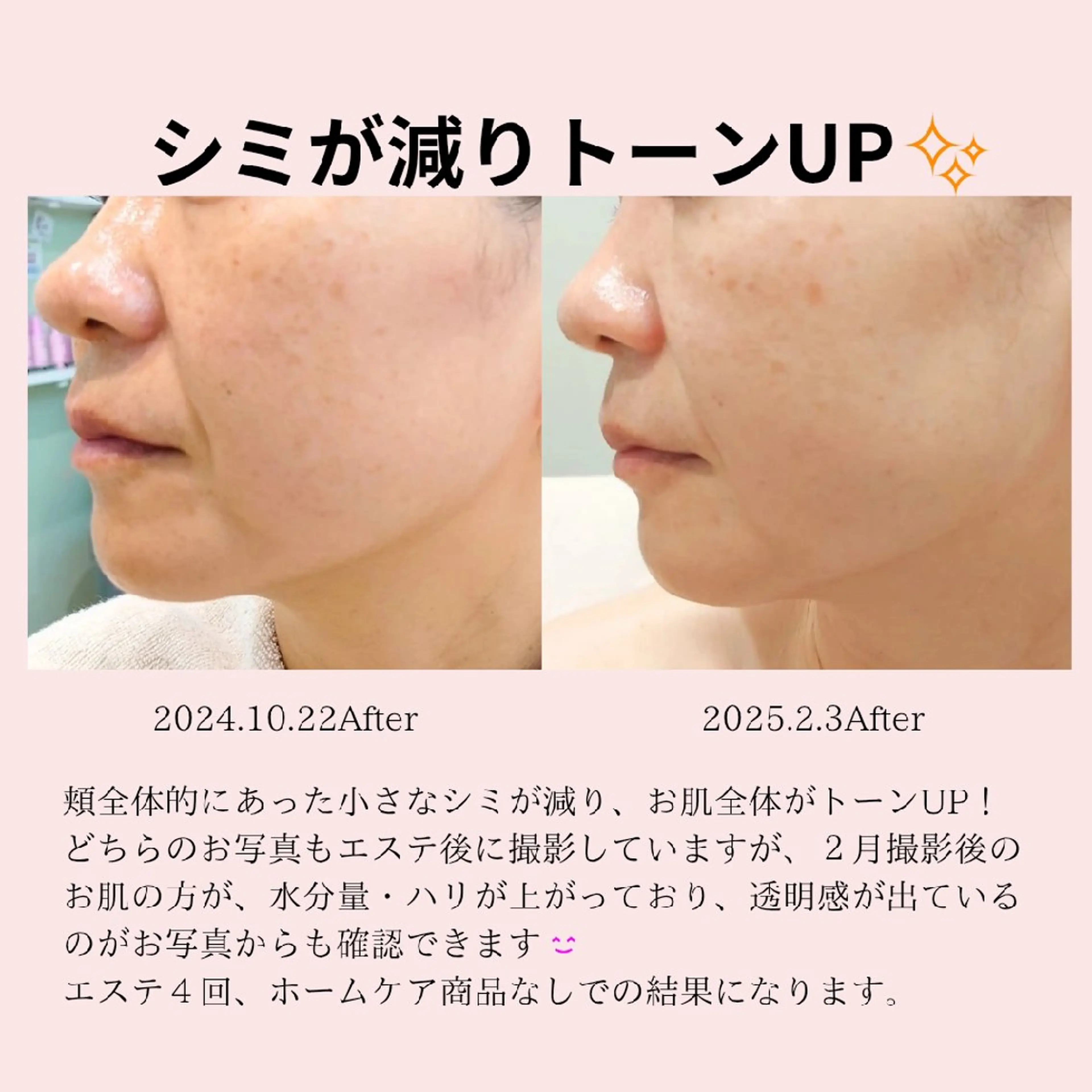 エステ フェイシャル/ボディ /ブライダル山田浩子のエステ・リラクイメージ