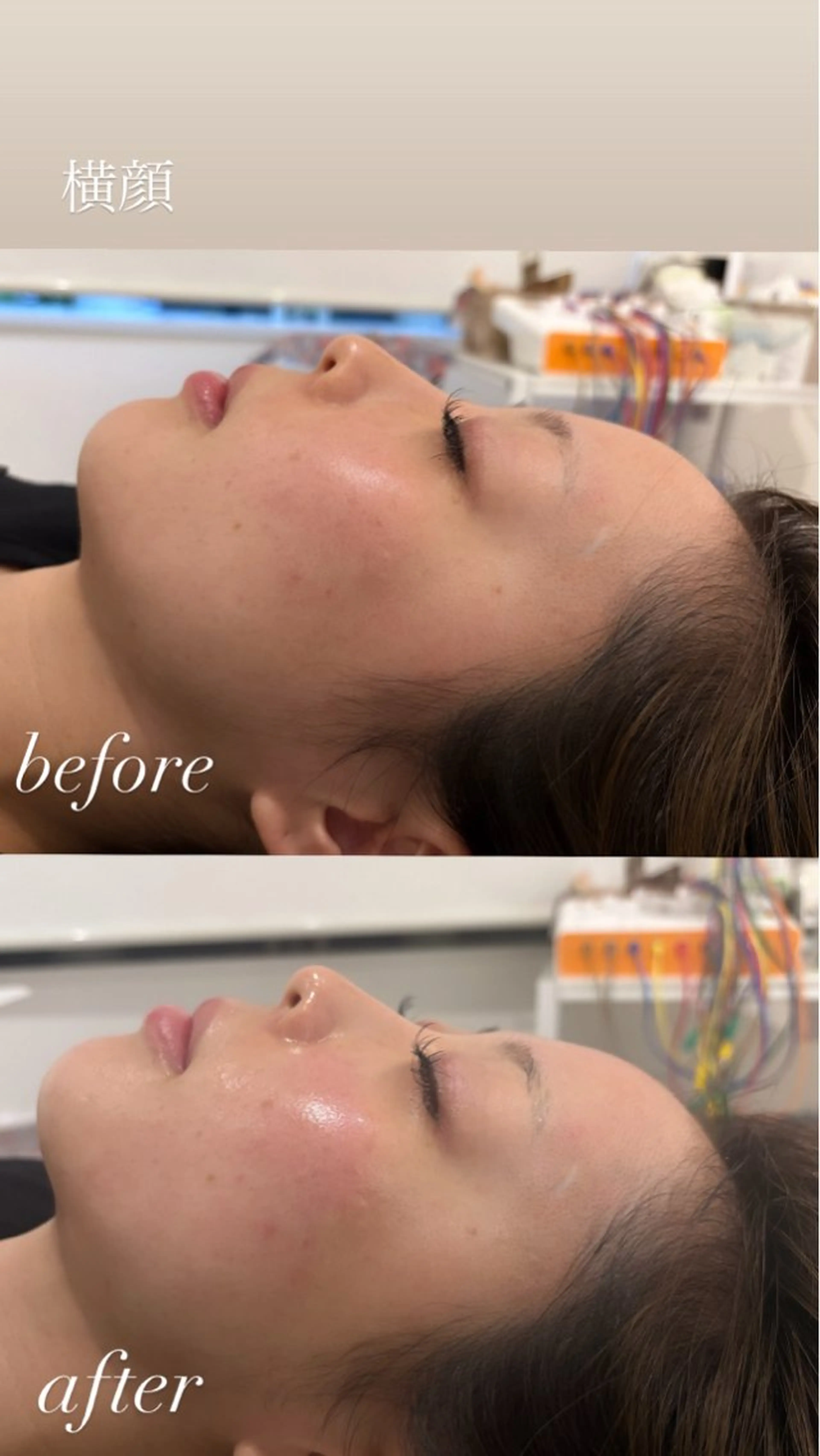 エステ リラク 美容鍼灸サロン mahoroba院長のエステ・リラクイメージ