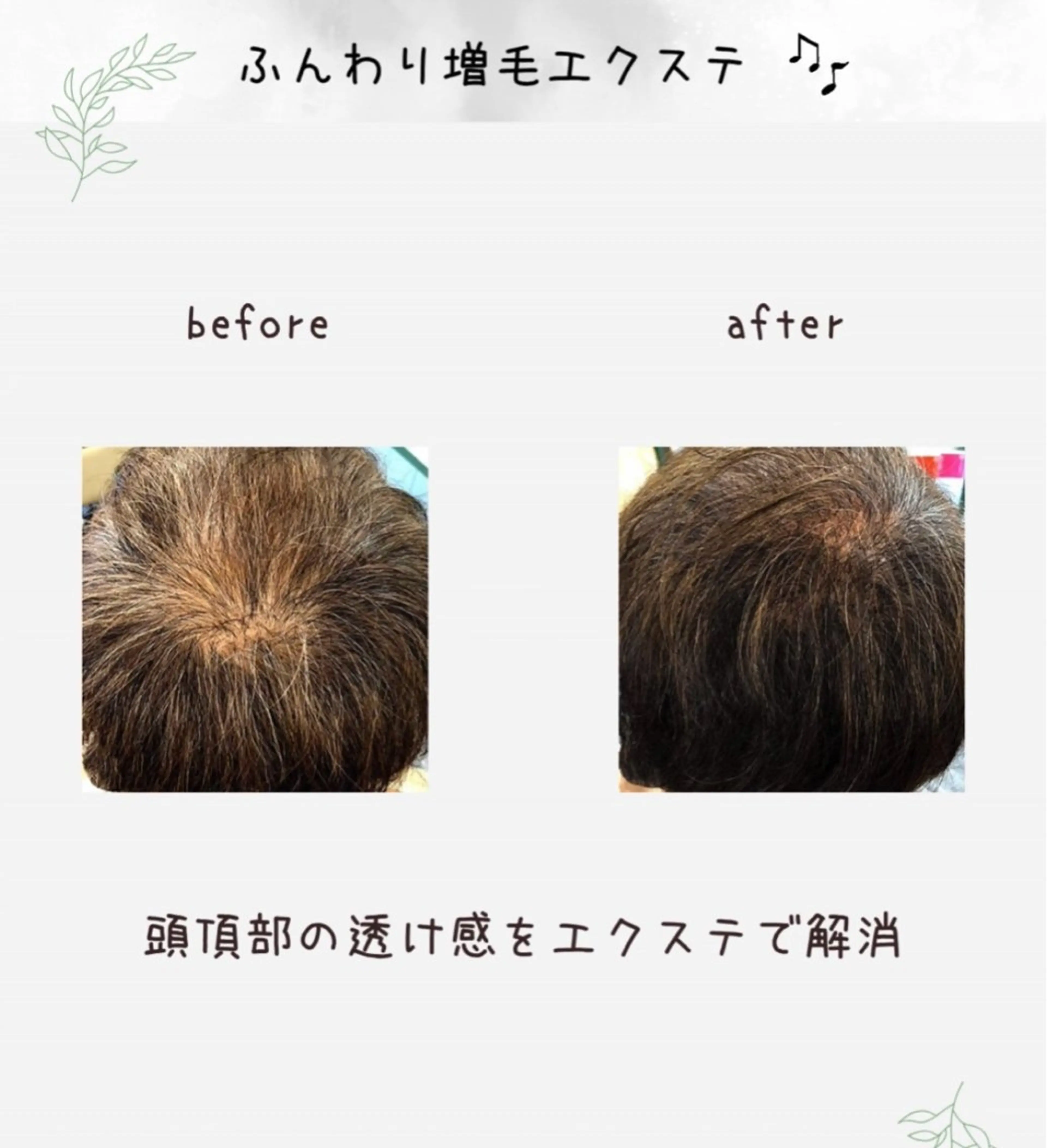 薄毛で悩んでる方向けの増毛エクステ 200〜300本の写真