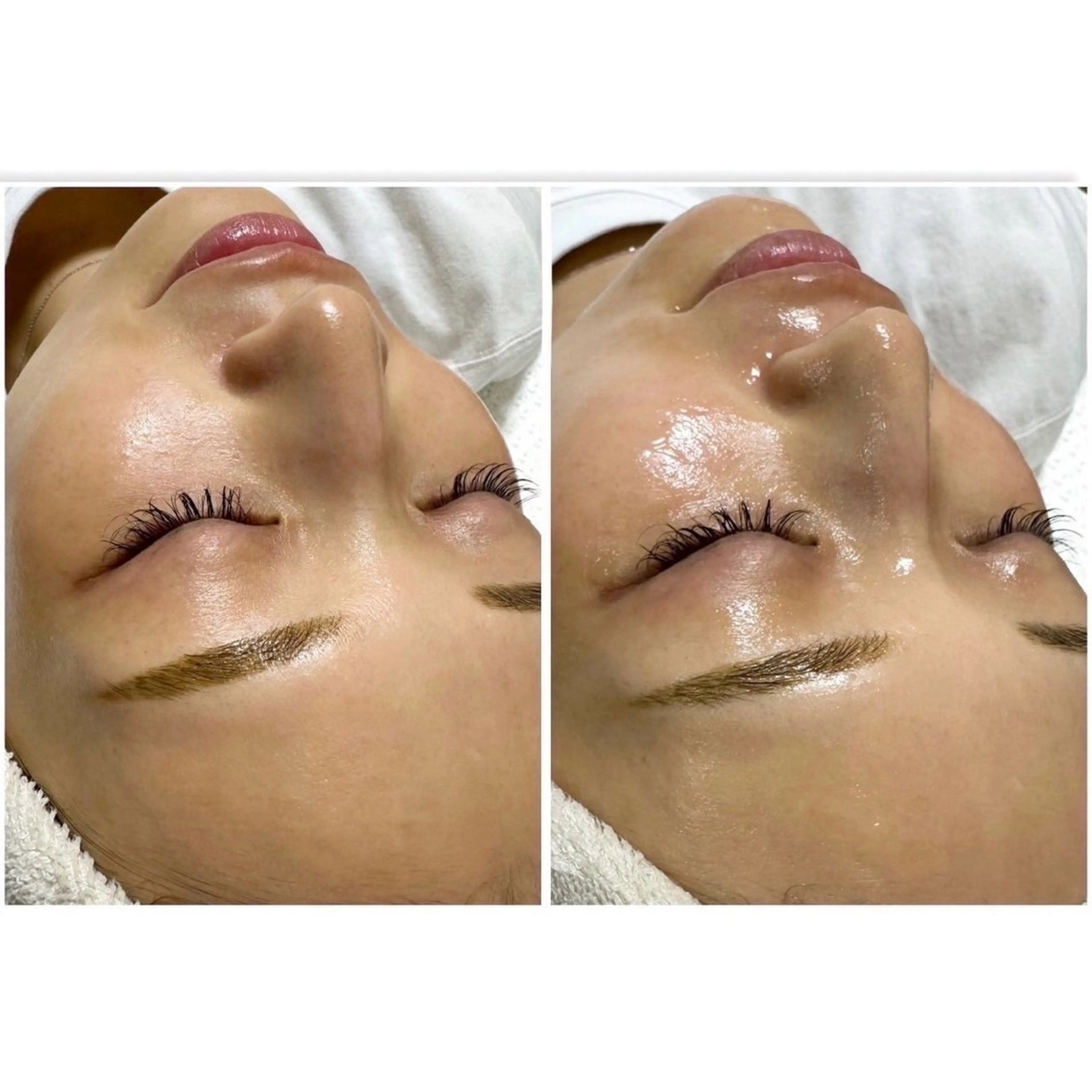 エステ yuuri. Sの眉毛・アイブロウイメージ