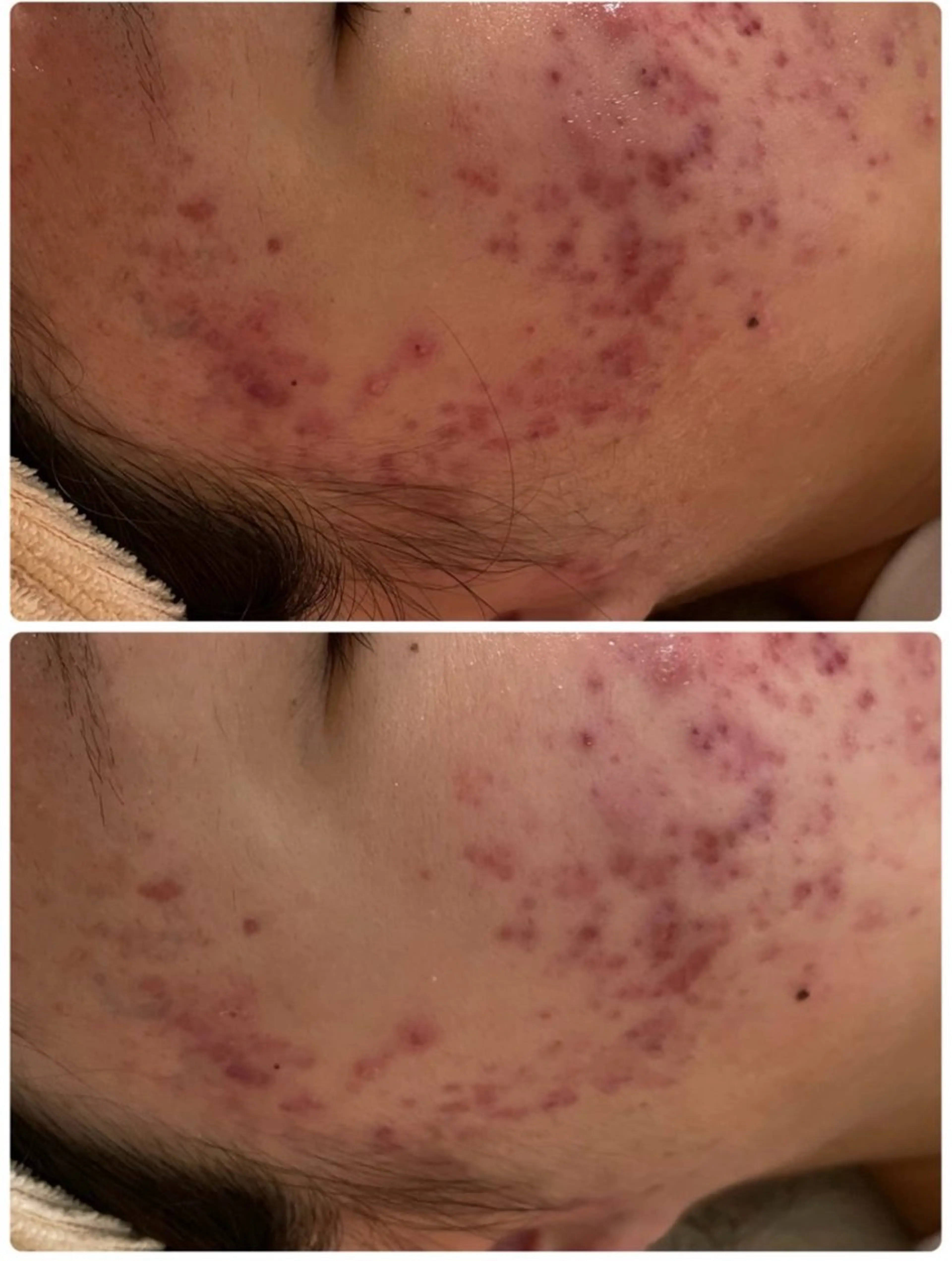 メンズ キッズ メンズ韓国風 美肌脱毛エステサロン Luangeのエステ・リラクイメージ