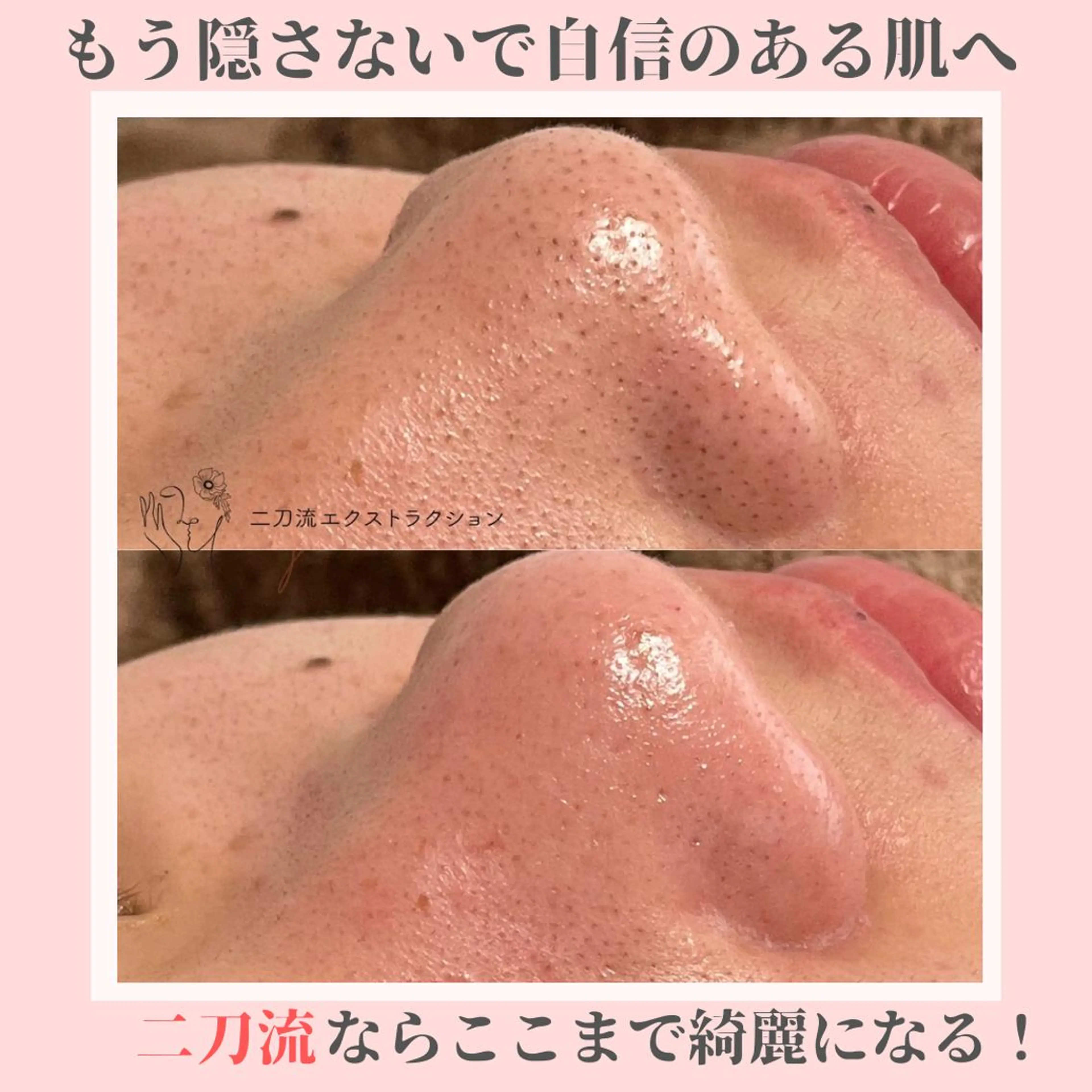 ピーリング専門店 Belluteのエステ・リラクイメージ