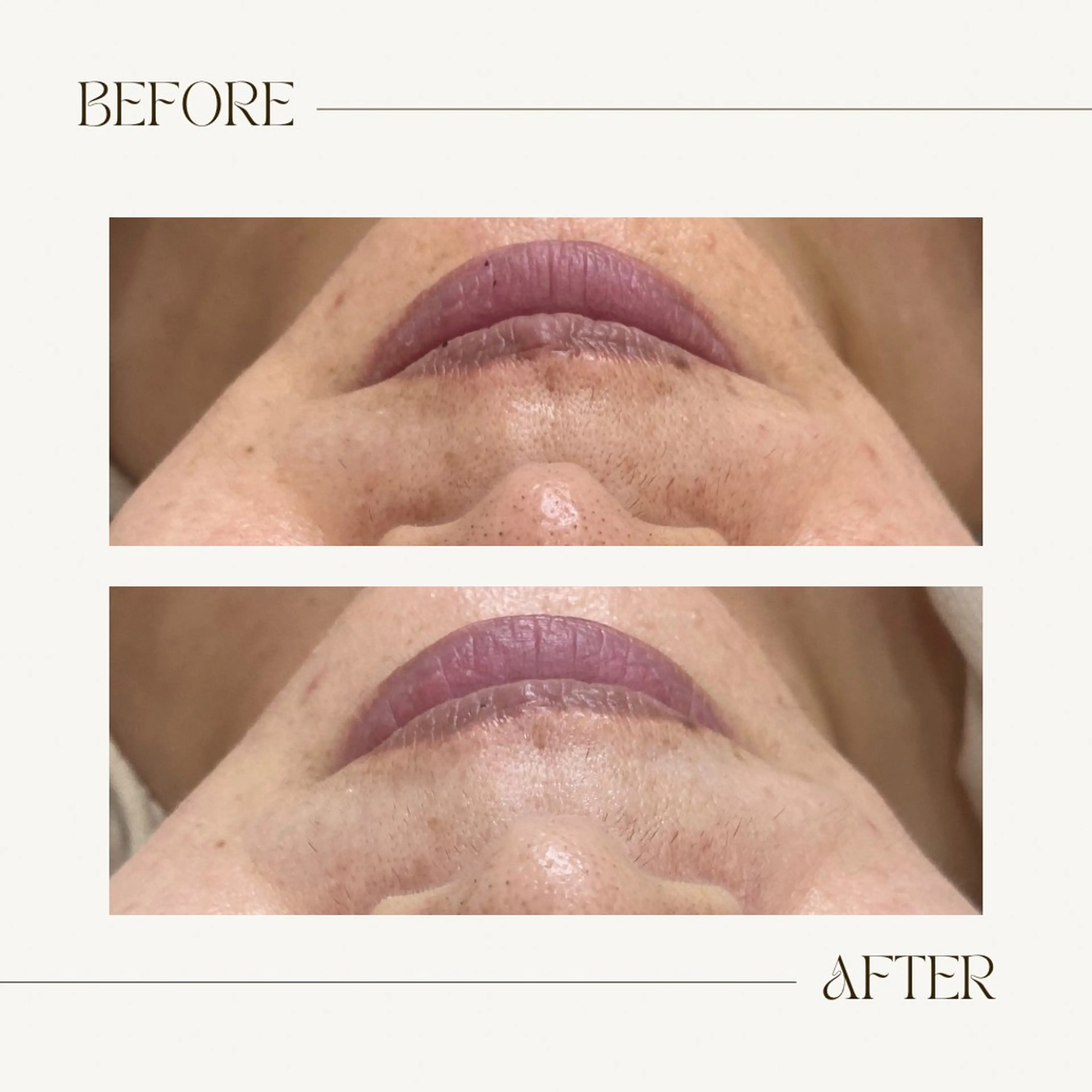 CEsalonEgg 齋藤のエステ・リラクイメージ