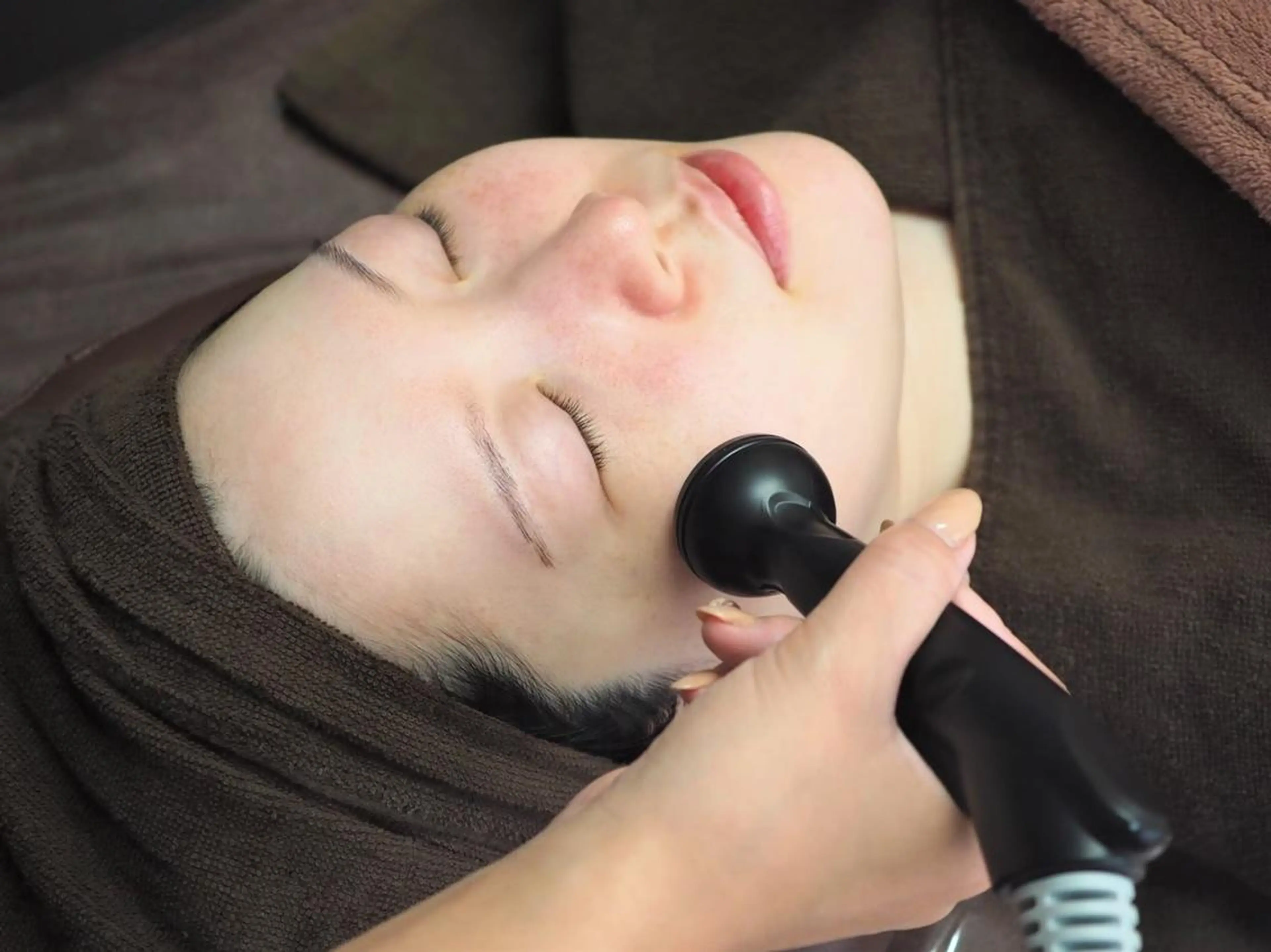 顔脱毛＋エレクトロポレーション☆練習モデルの写真