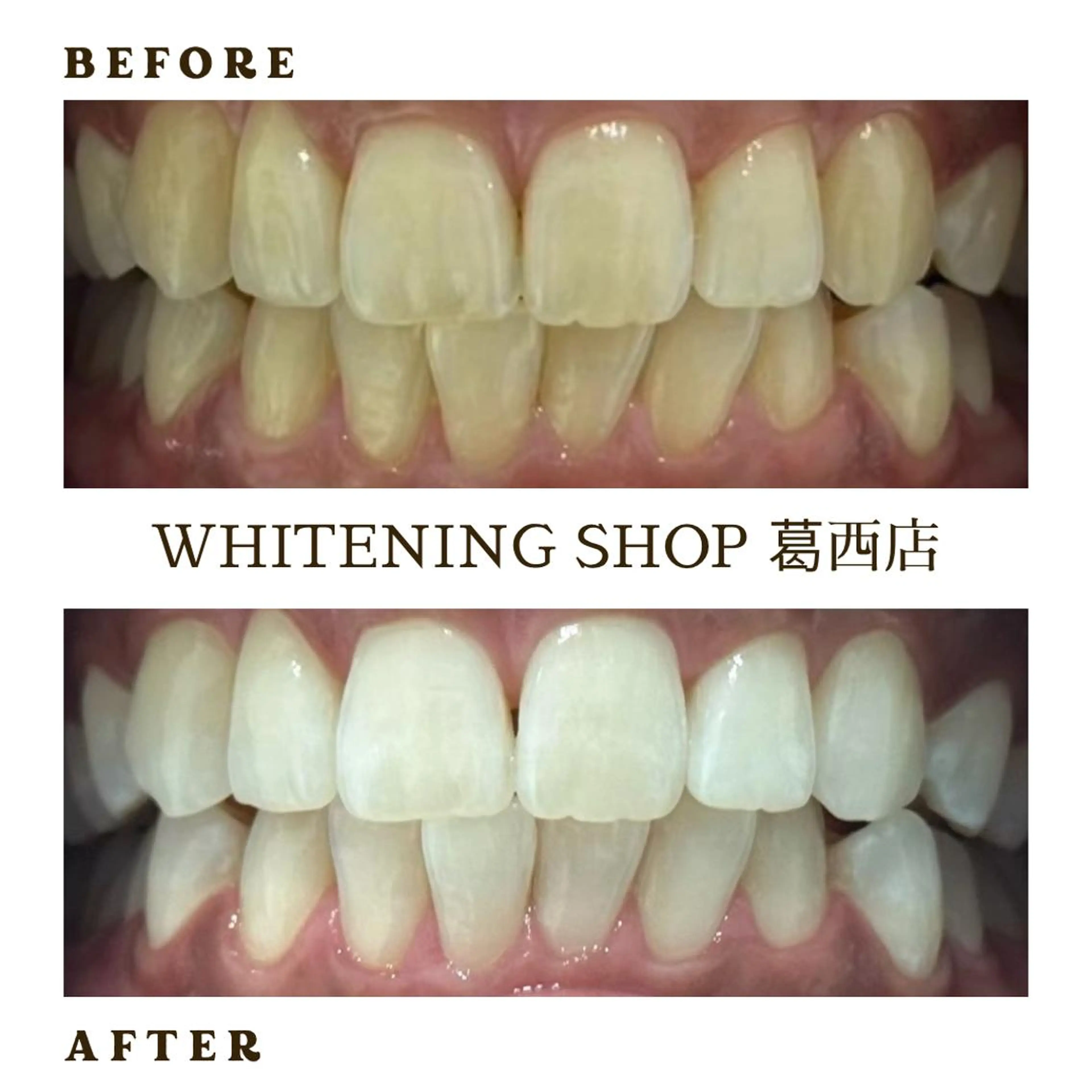 メンズ その他 ホワイトニング ショップ葛西店のその他イメージ