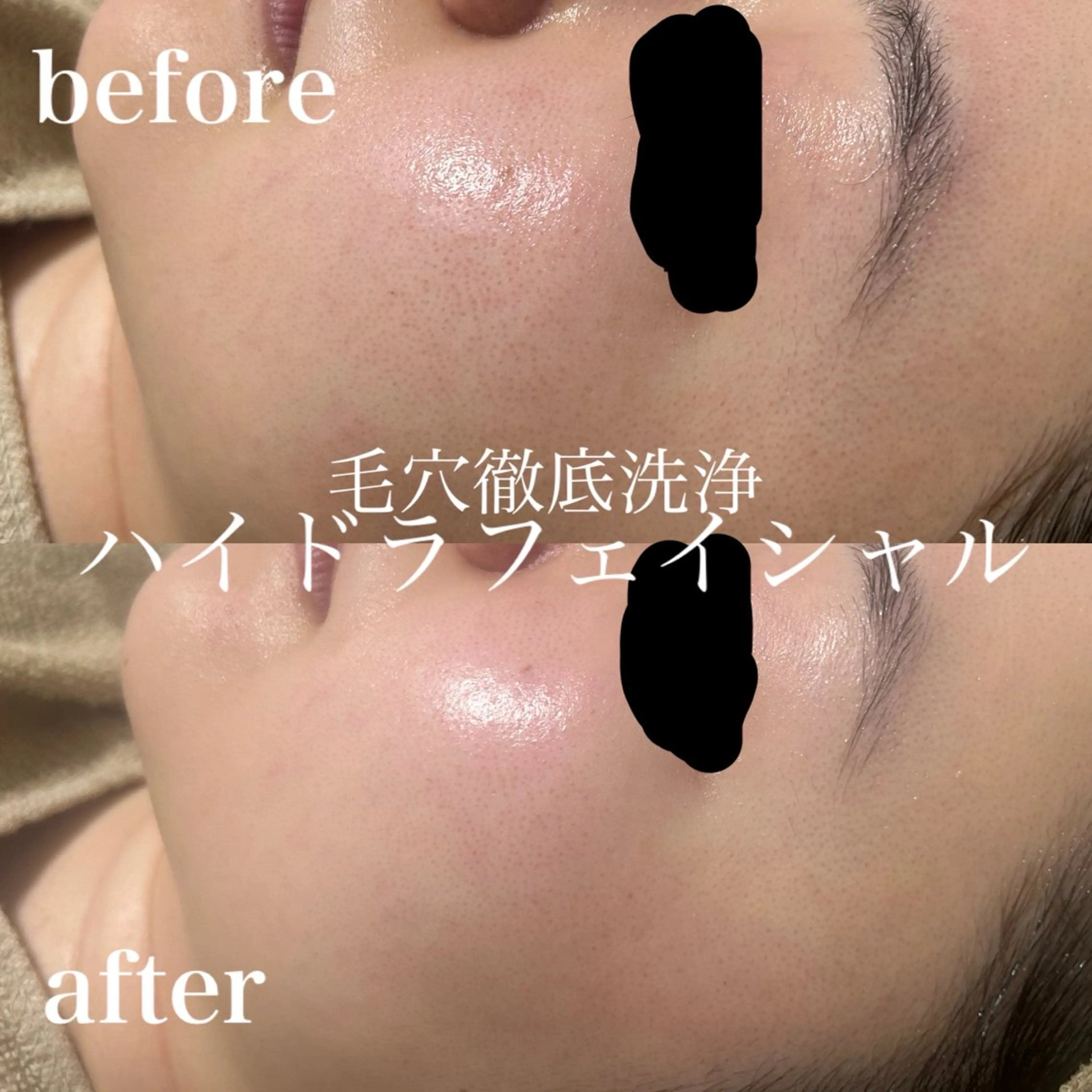 エステ フェイシャルサロン CHIARA 荒田のエステ・リラクイメージ