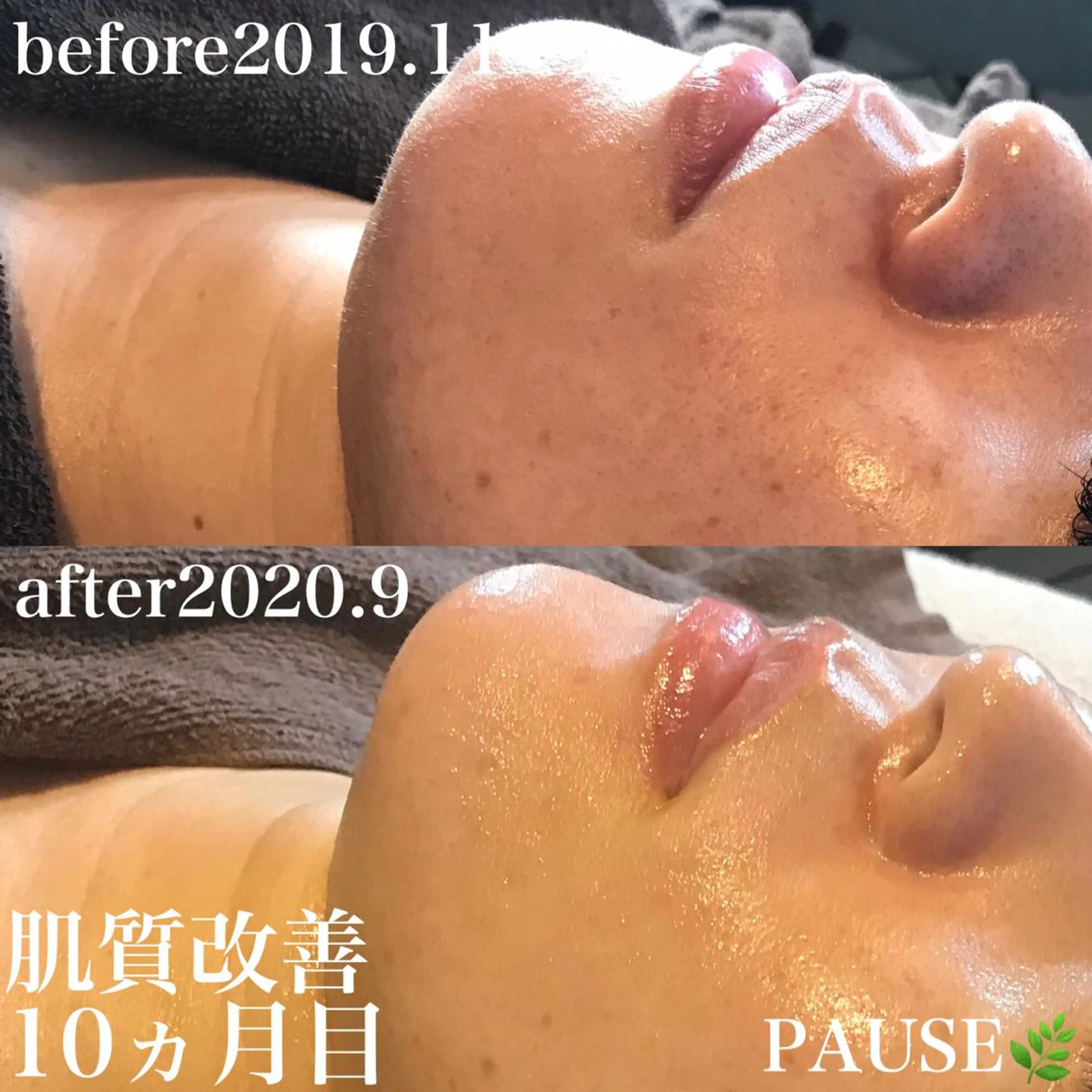 エステ 浜野 恵美のエステ・リラクイメージ