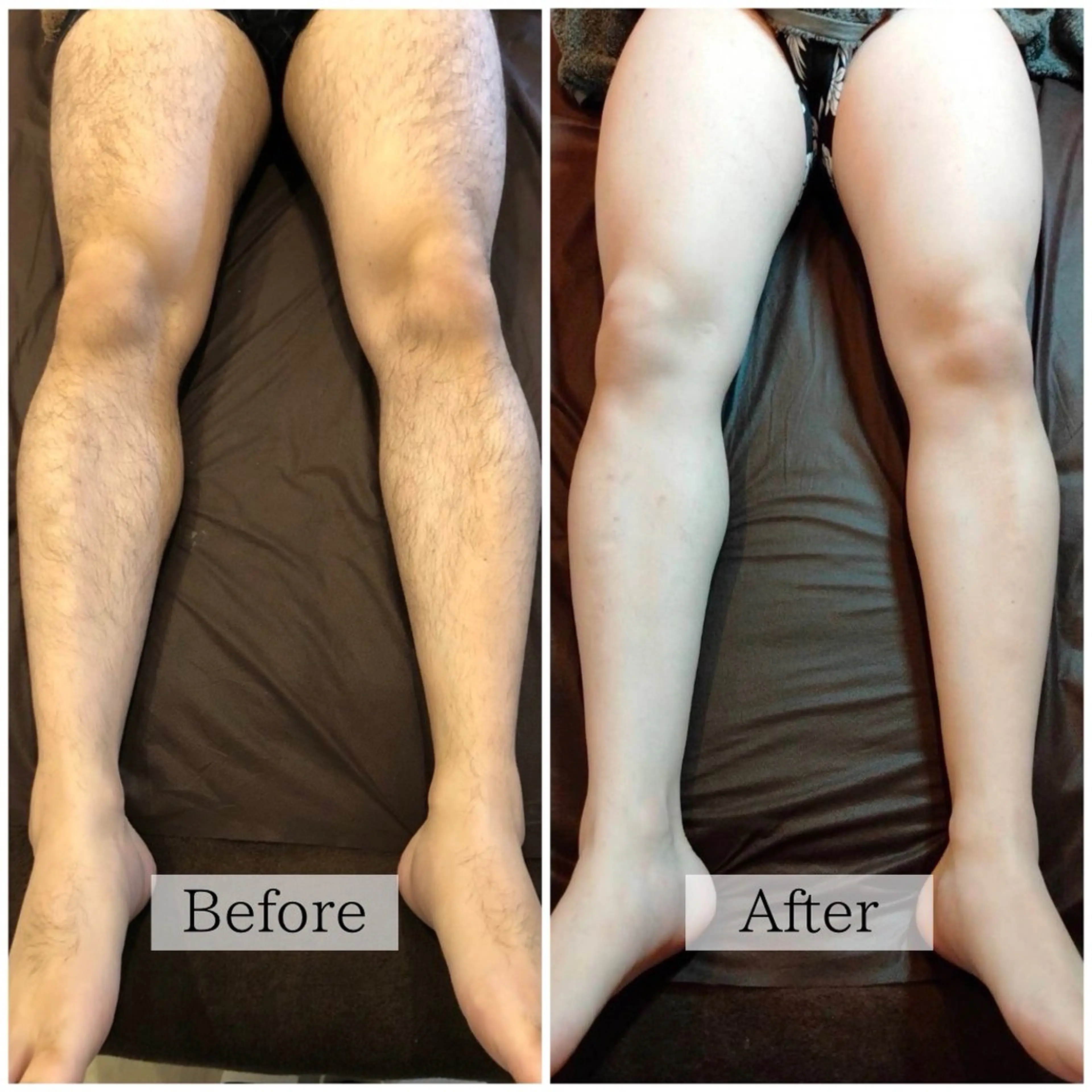 脱毛 加藤 葵のエステ・リラクイメージ