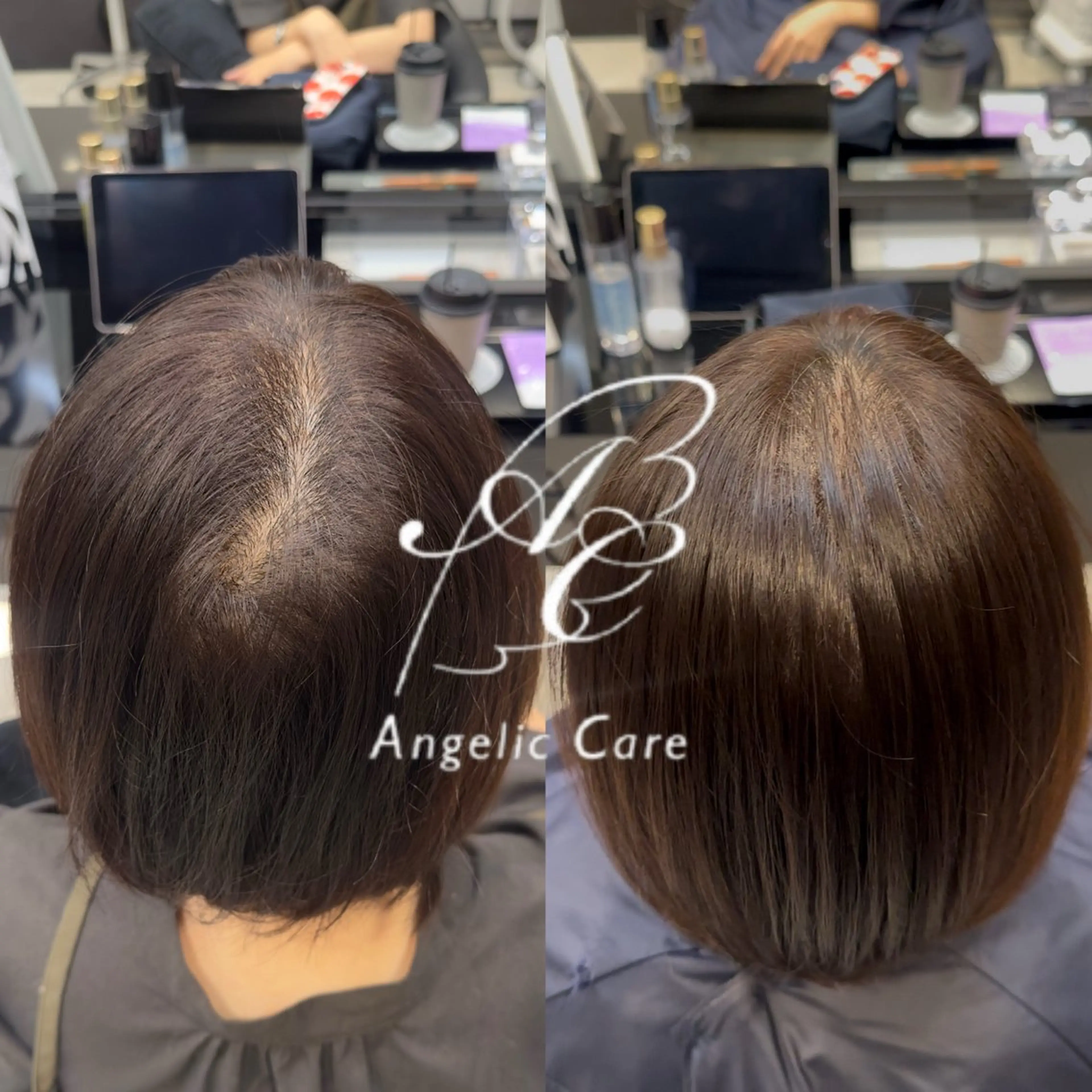 ショート トリートメント HARUKI MINATO Japan福岡店所属・小北 つつみのヘアスタイル